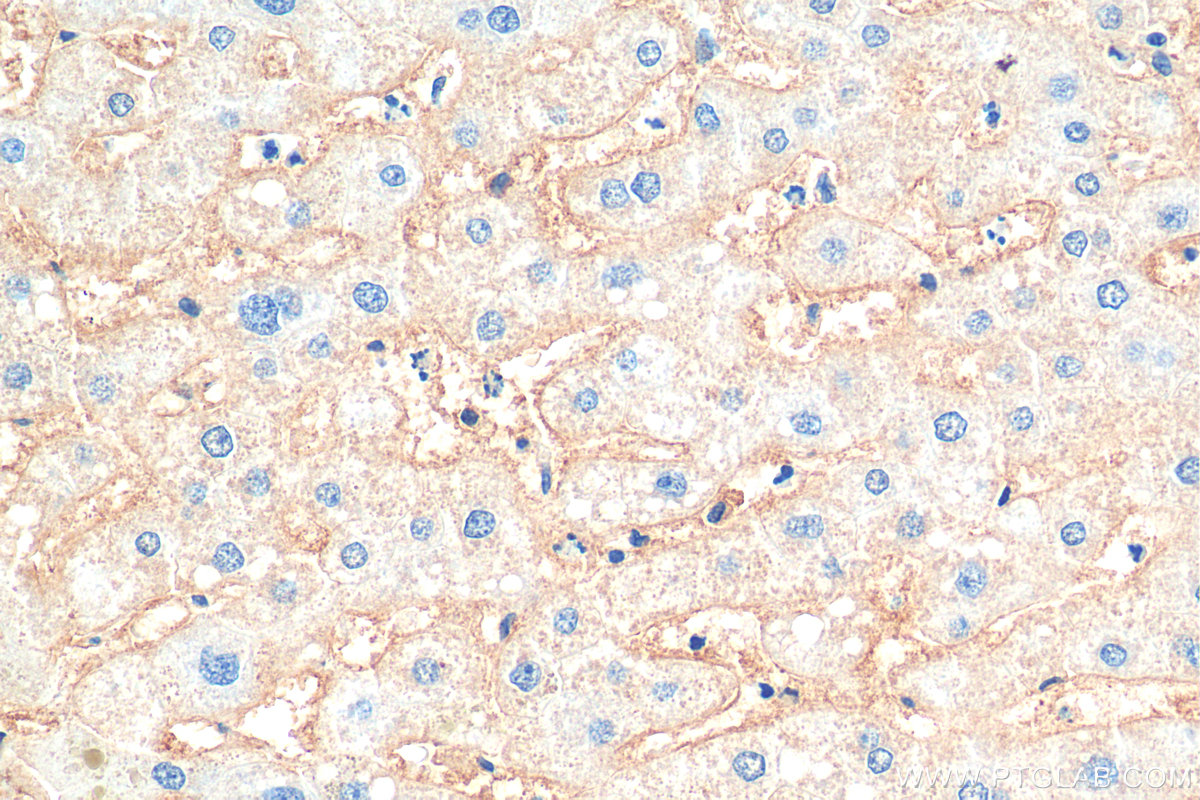 IHC staining of human liver using Biotin-66866