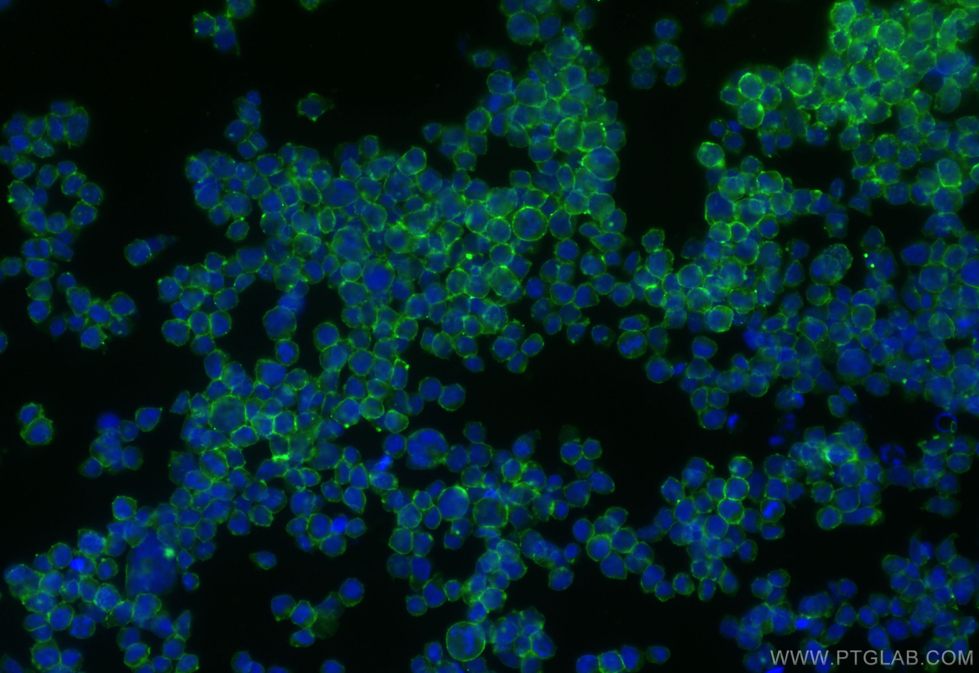 IF Staining of Jurkat using CL488-84644-2