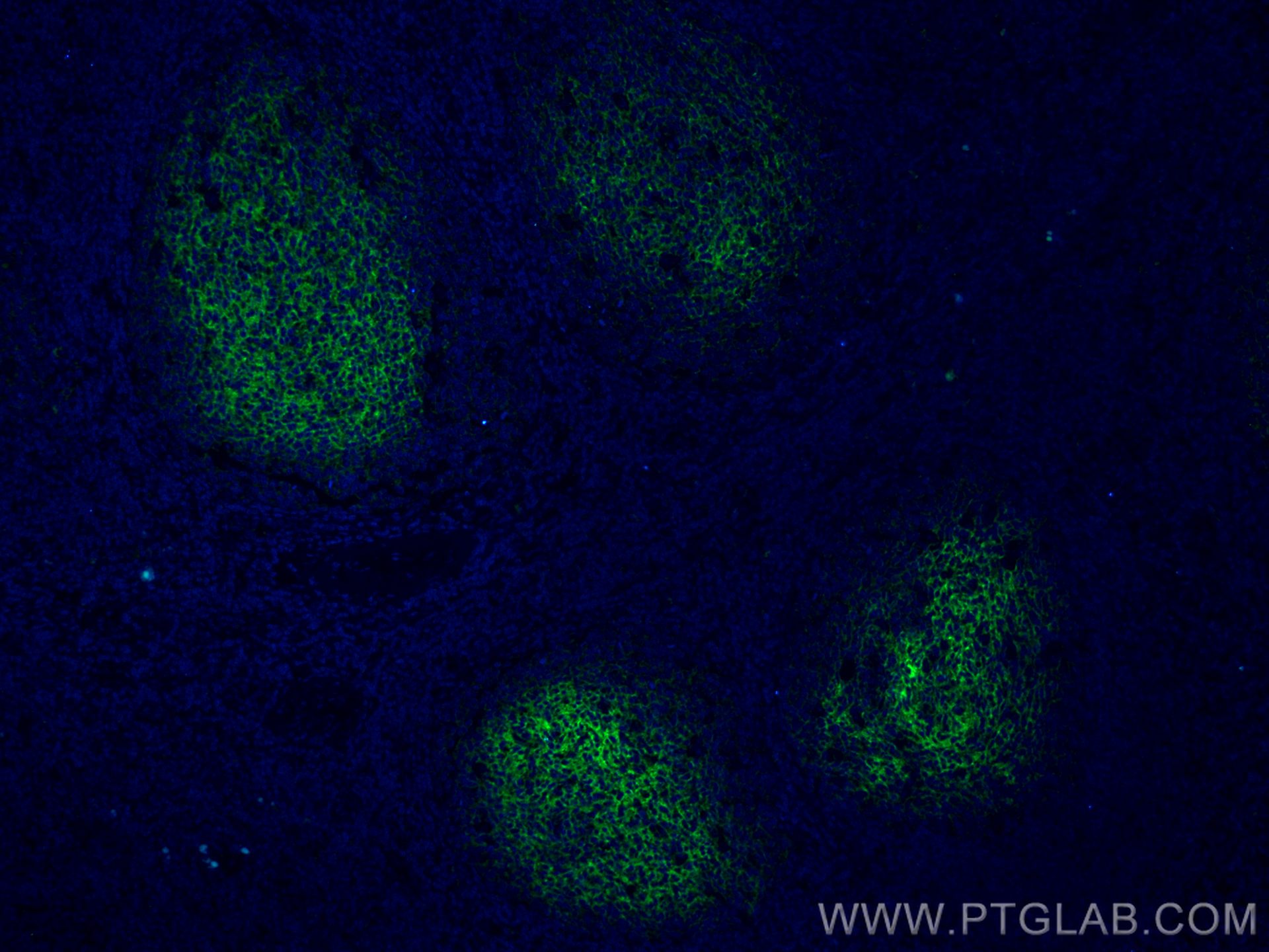 IF Staining of human tonsillitis using 66803-1-Ig (same clone as 66803-1-PBS)