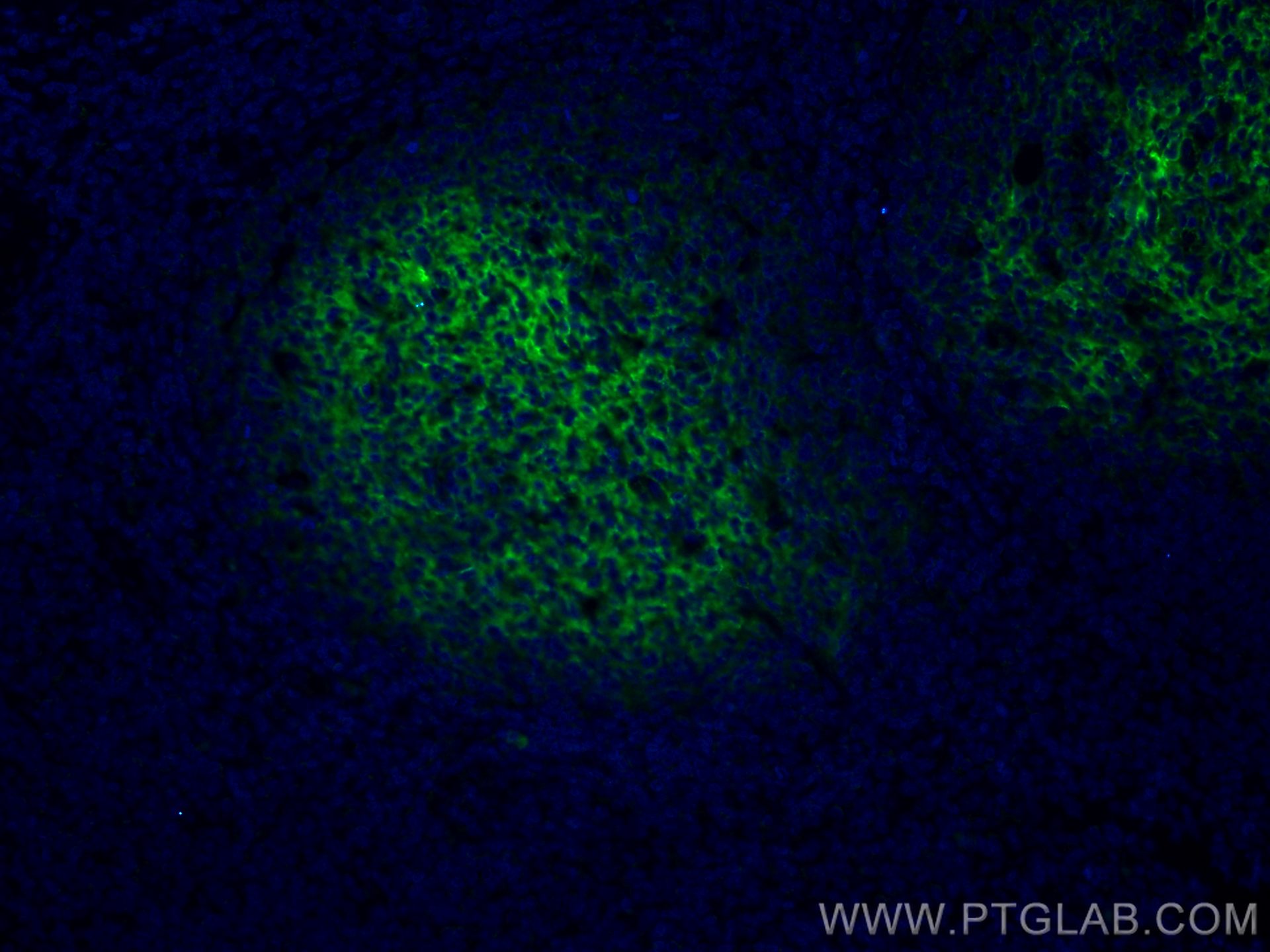 IF Staining of human tonsillitis using 66803-1-Ig (same clone as 66803-1-PBS)