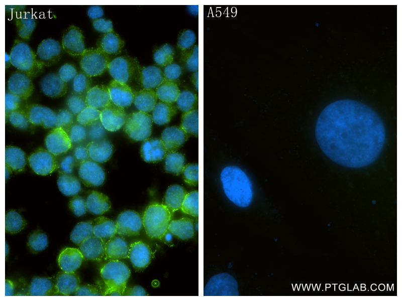 Immunofluorescent analysis of (4% PFA) fixed Jurkat cells using CD82 antibody (84617-7-RR, Clone: 241765G7 ) at dilution of 1:500 and CoraLite®488-Conjugated Goat Anti-Rabbit IgG(H+L) (<a class='green' href='/productredirect?CatalogNo=SA00013-2' target='_blank'>SA00013-2</a>). IF Staining of Jurkat using 84617-7-RR