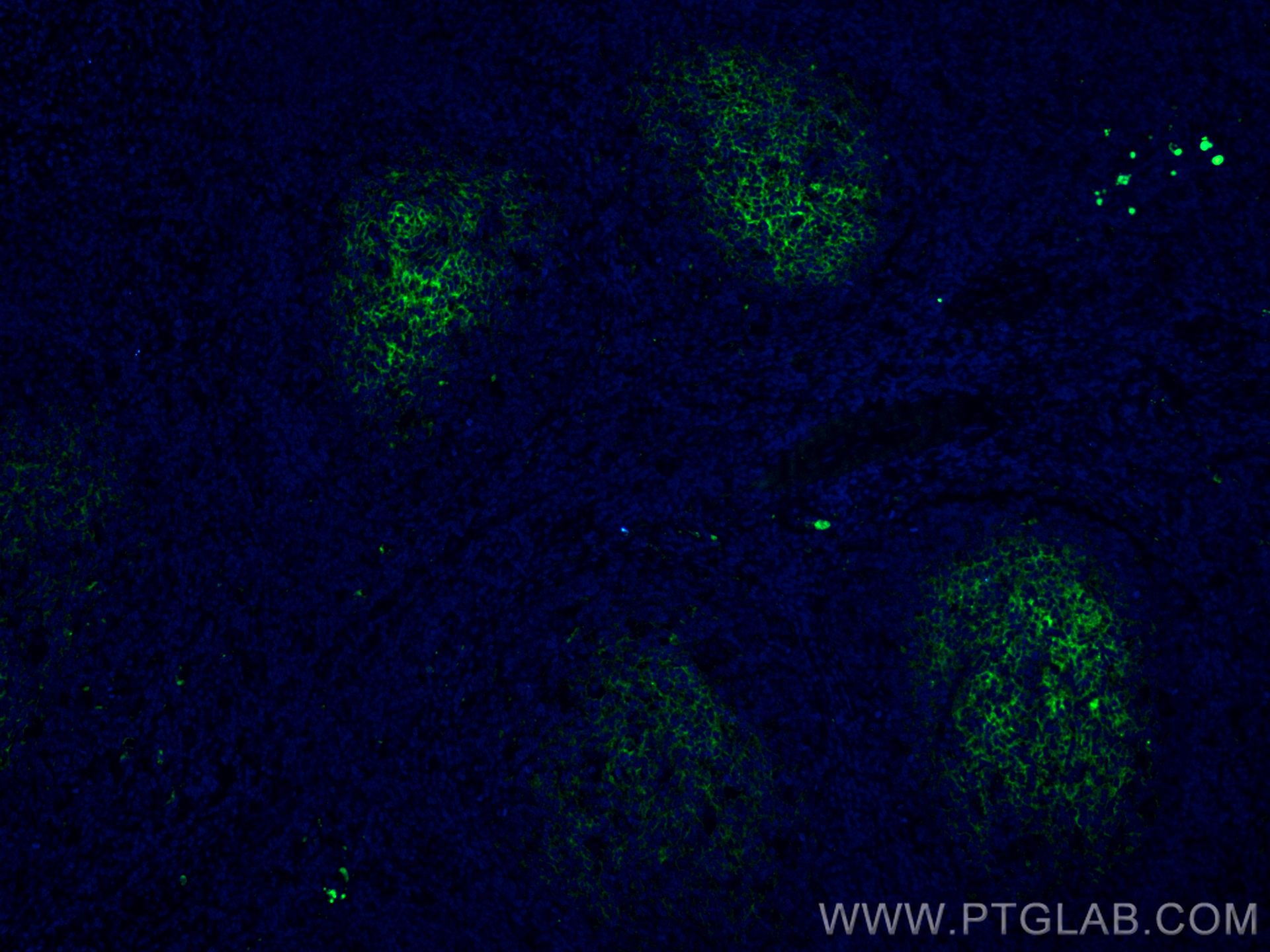 IF Staining of human tonsillitis using CL488-66803