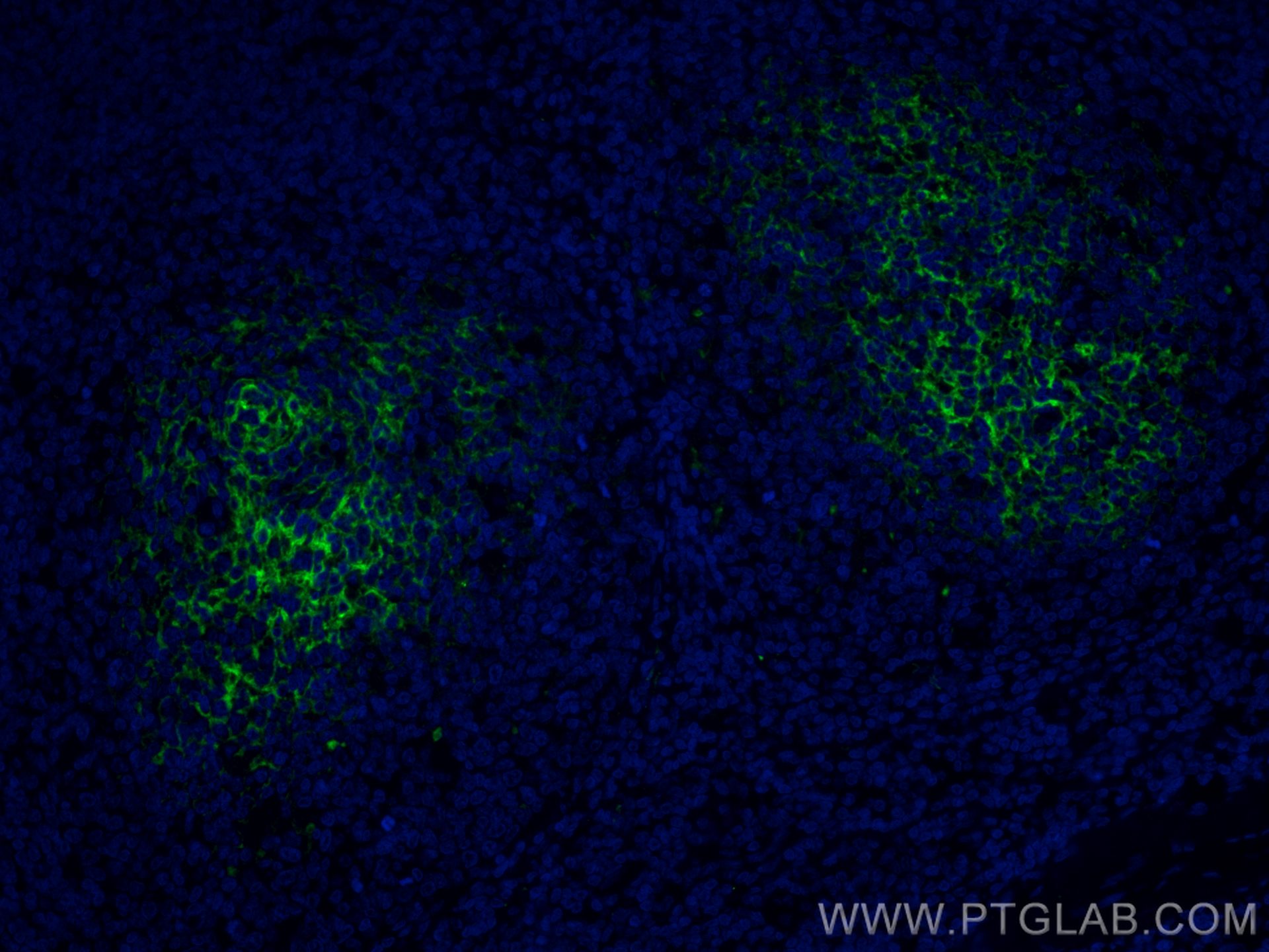 IF Staining of human tonsillitis using CL488-66803