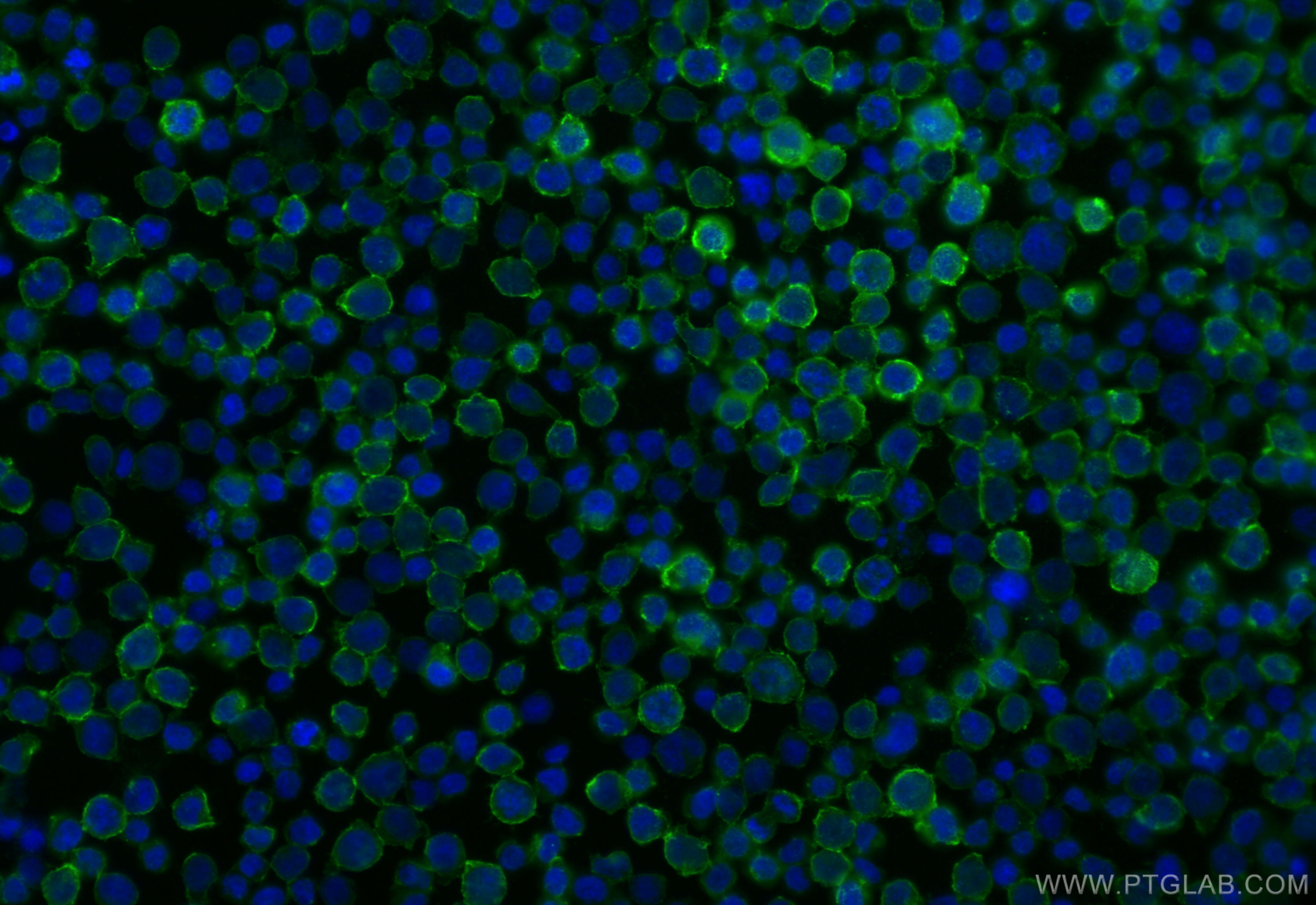 IF Staining of Jurkat using CL488-84617-3