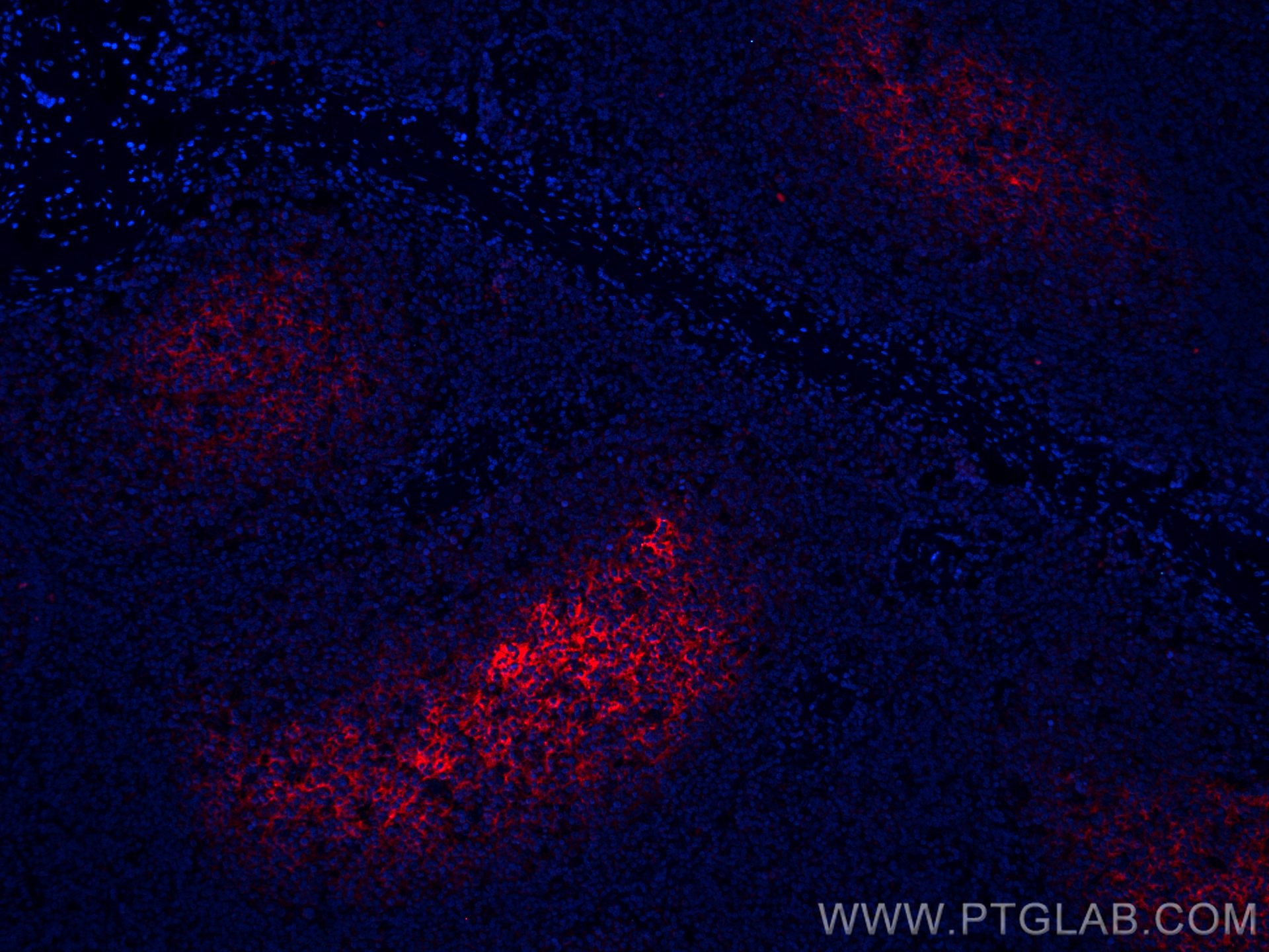 IF Staining of human tonsillitis using CL594-66803