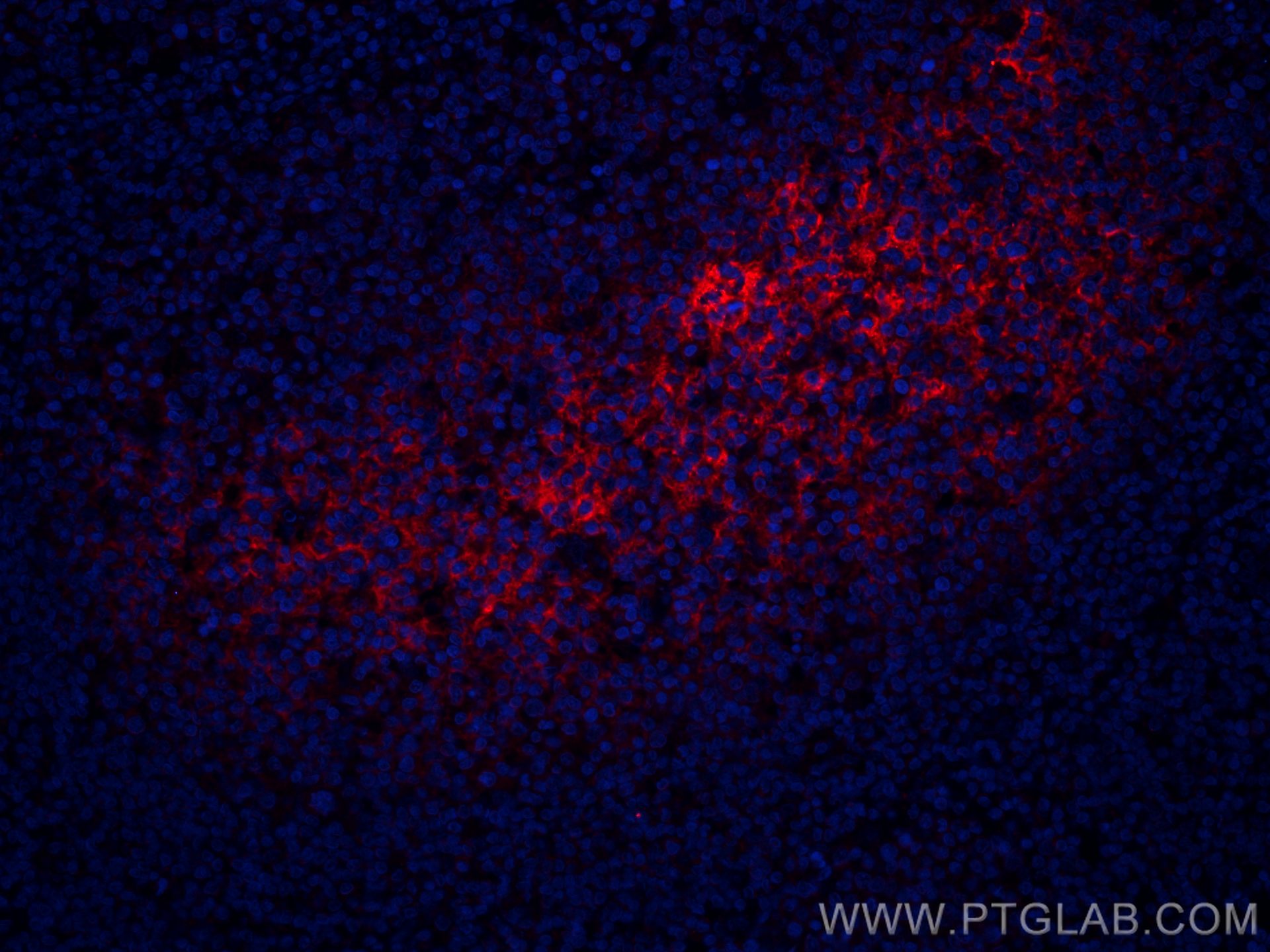 IF Staining of human tonsillitis using CL594-66803