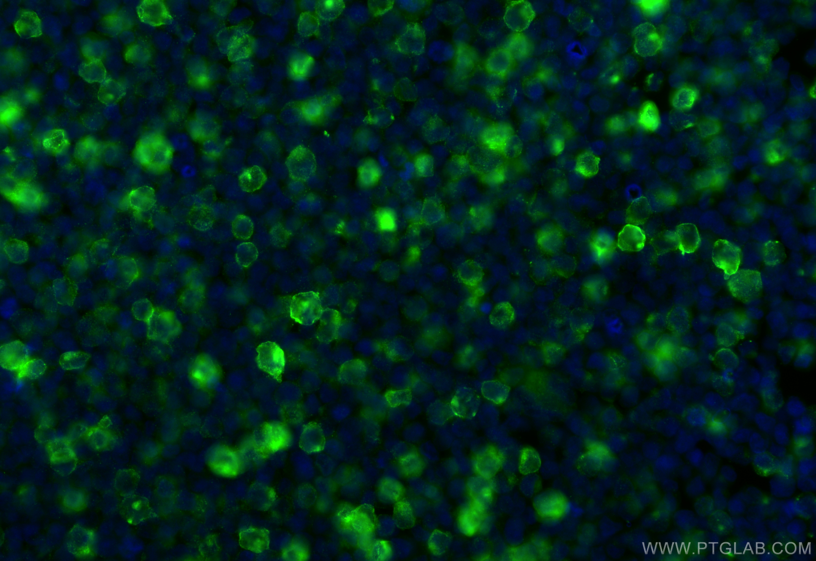 IF Staining of Raji using 65581-1-MR