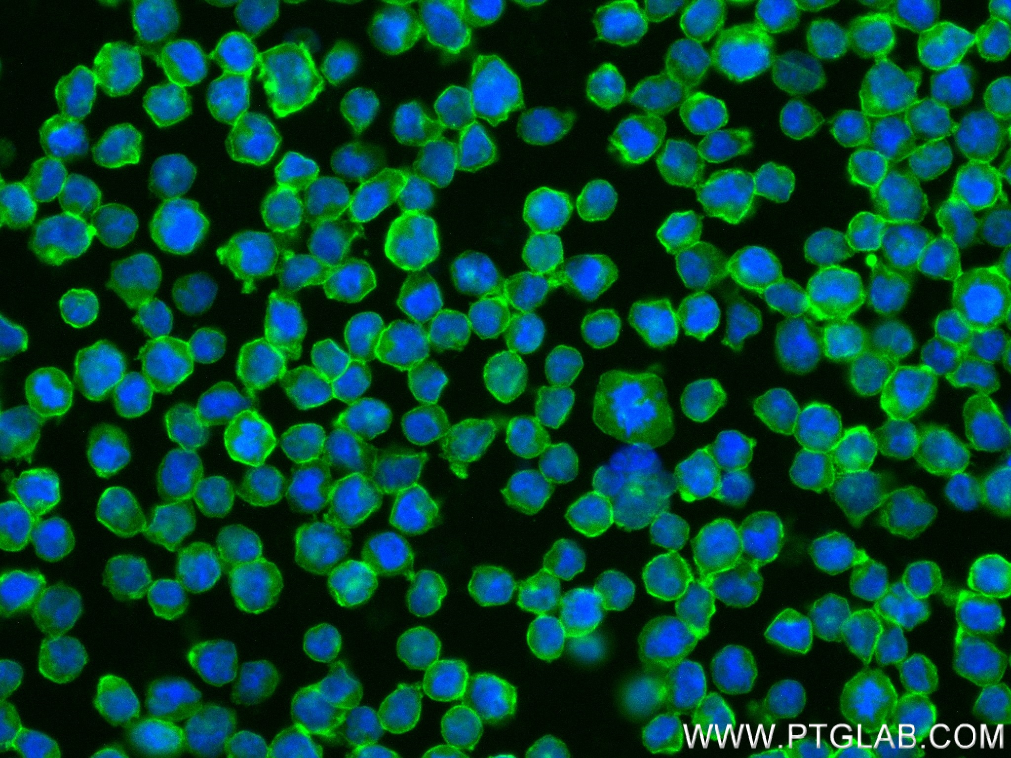 IF Staining of Raji using 84245-2-RR