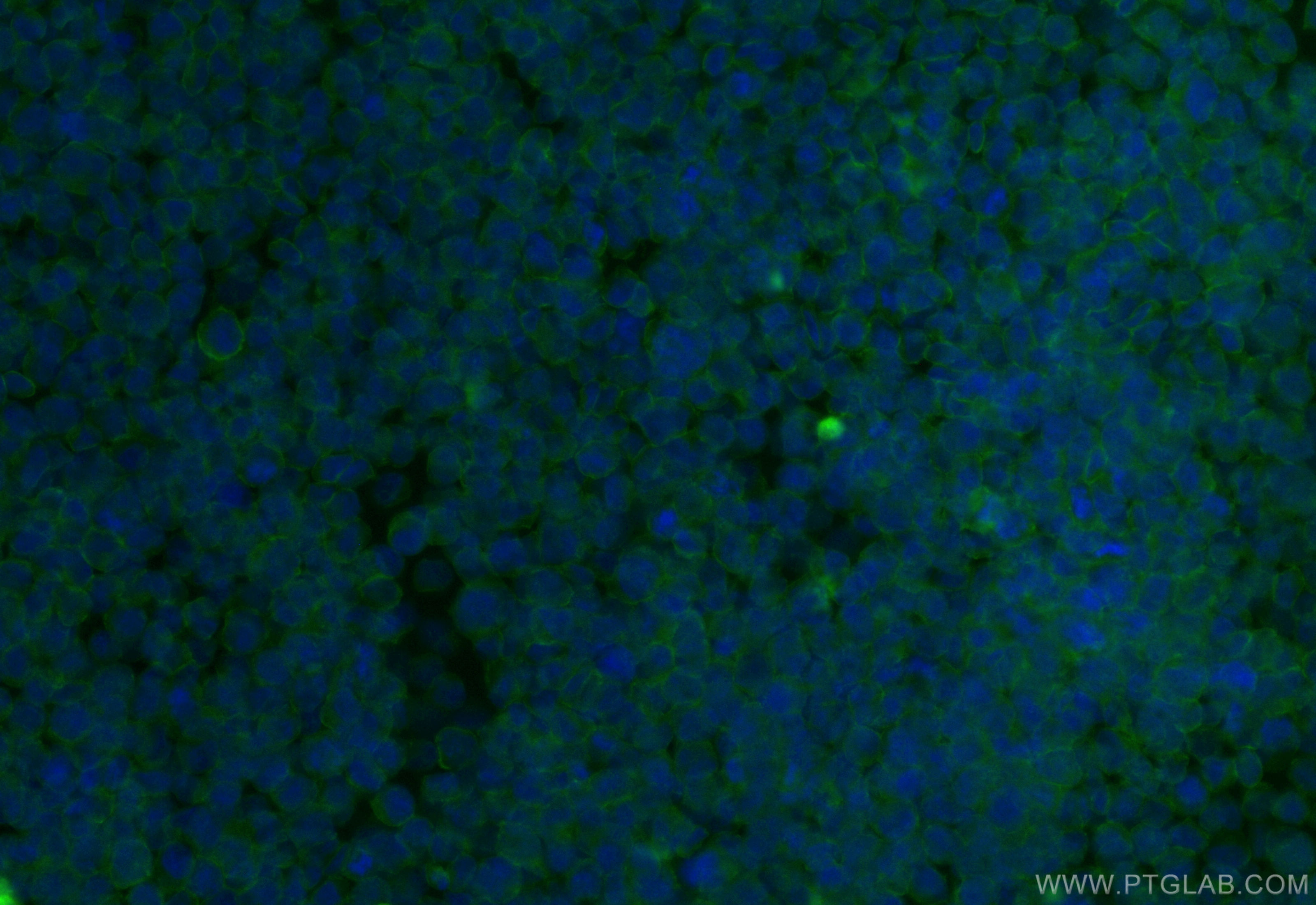 IF Staining of raji using CL488-84245-2