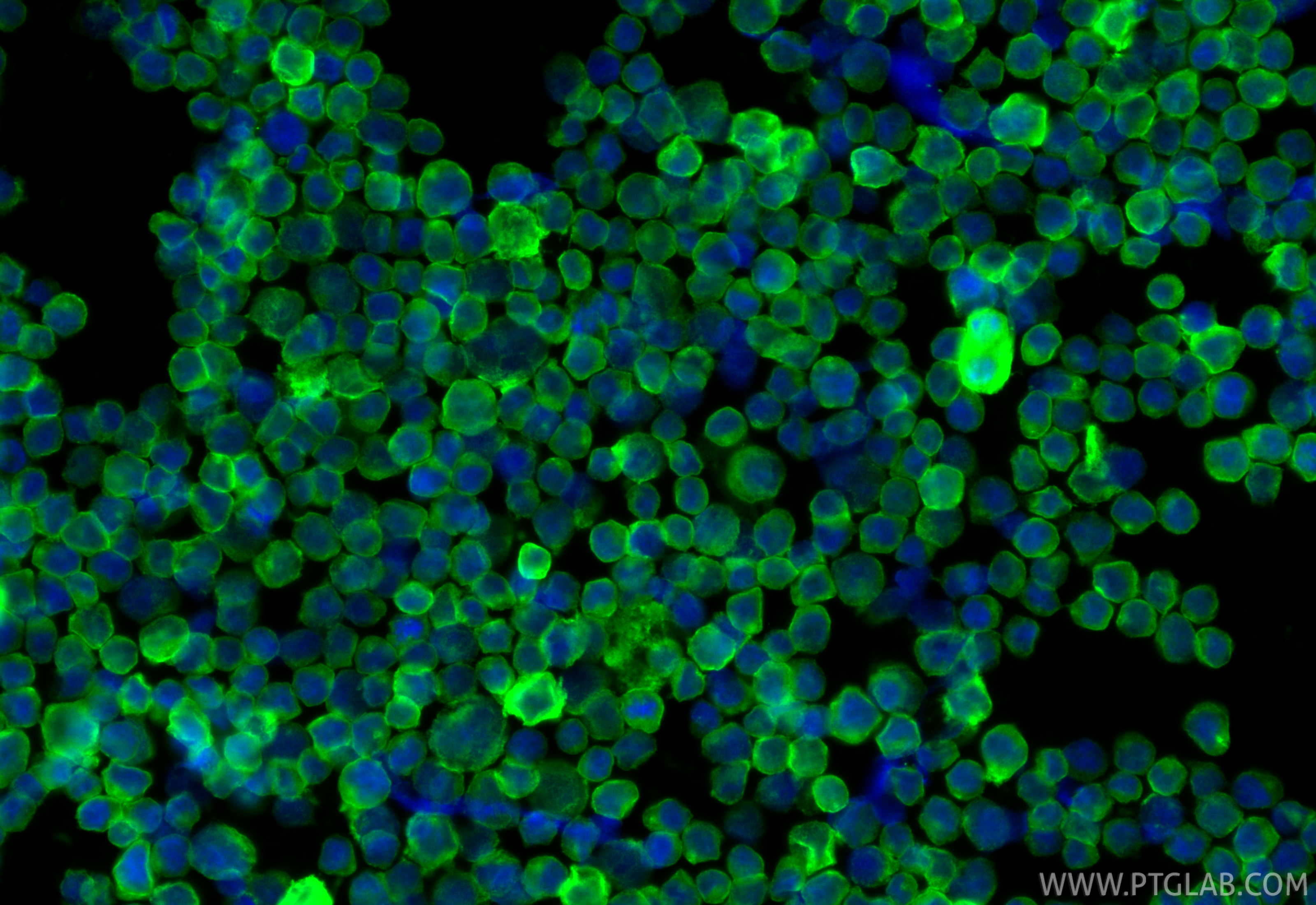 IF Staining of Raji using 31449-1-AP