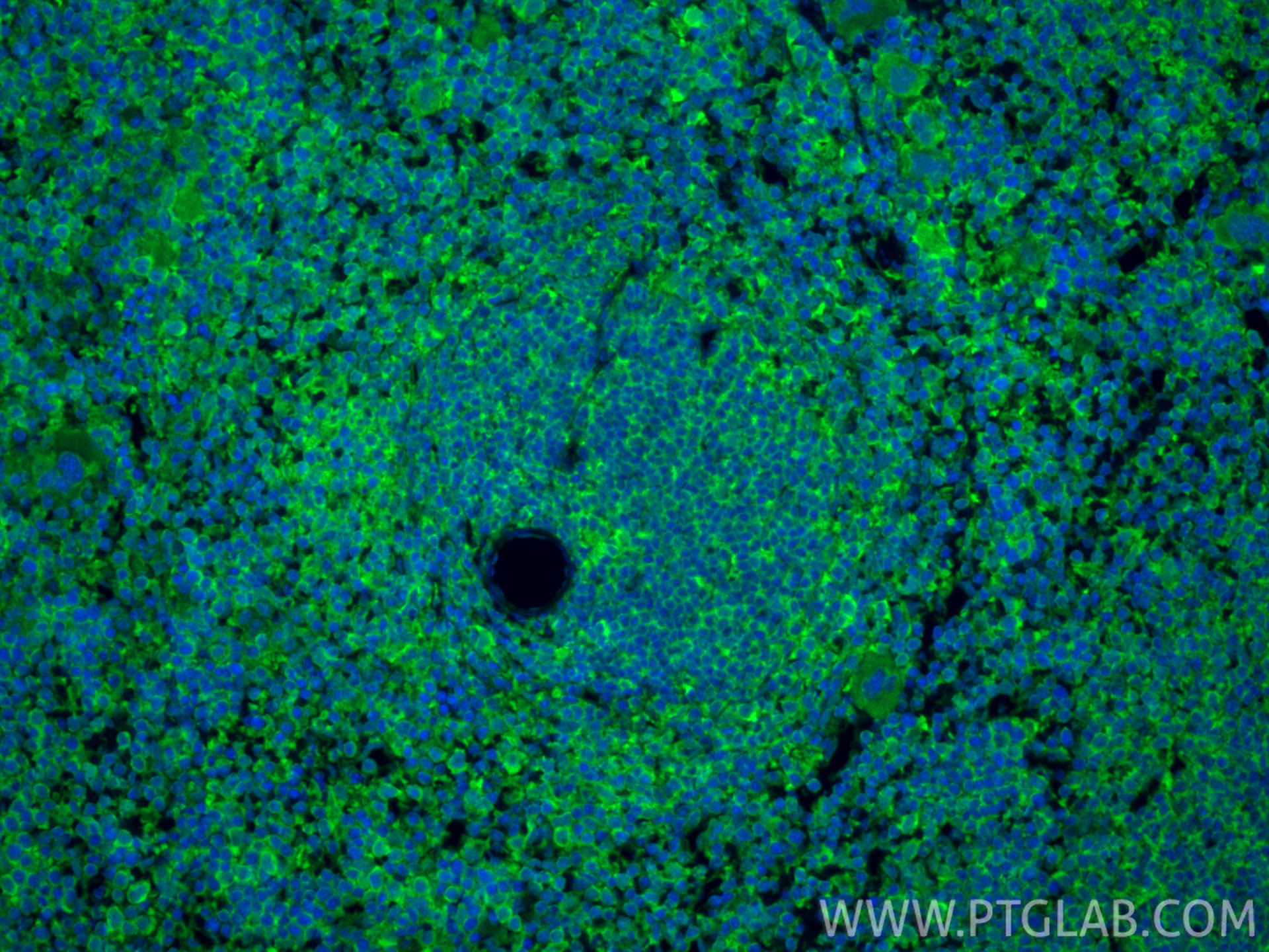 IF Staining of mouse spleen using 83213-1-RR IF Staining of mouse spleen using 83213-1-RR