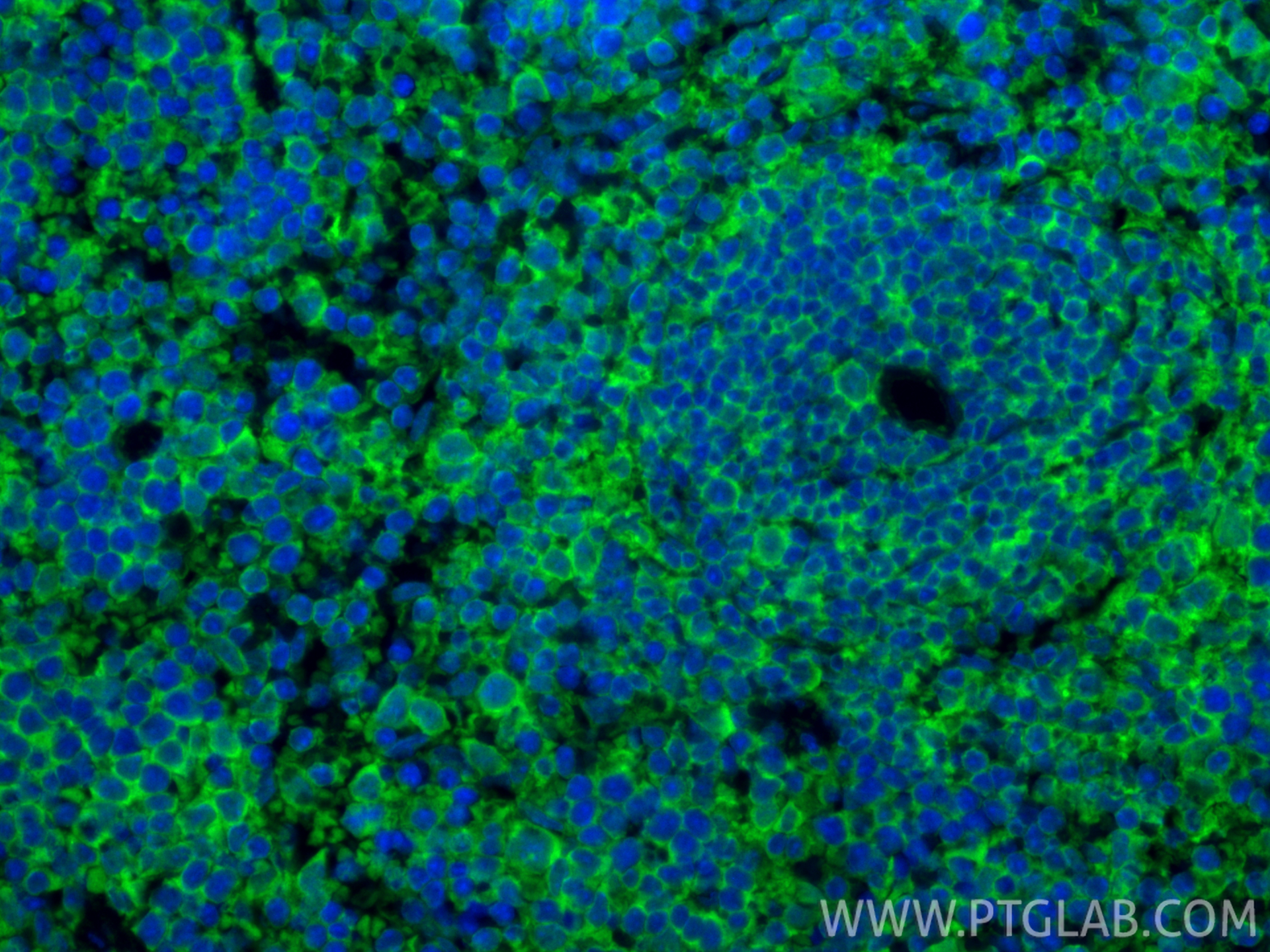 IF Staining of mouse spleen using 83213-1-RR IF Staining of mouse spleen using 83213-1-RR