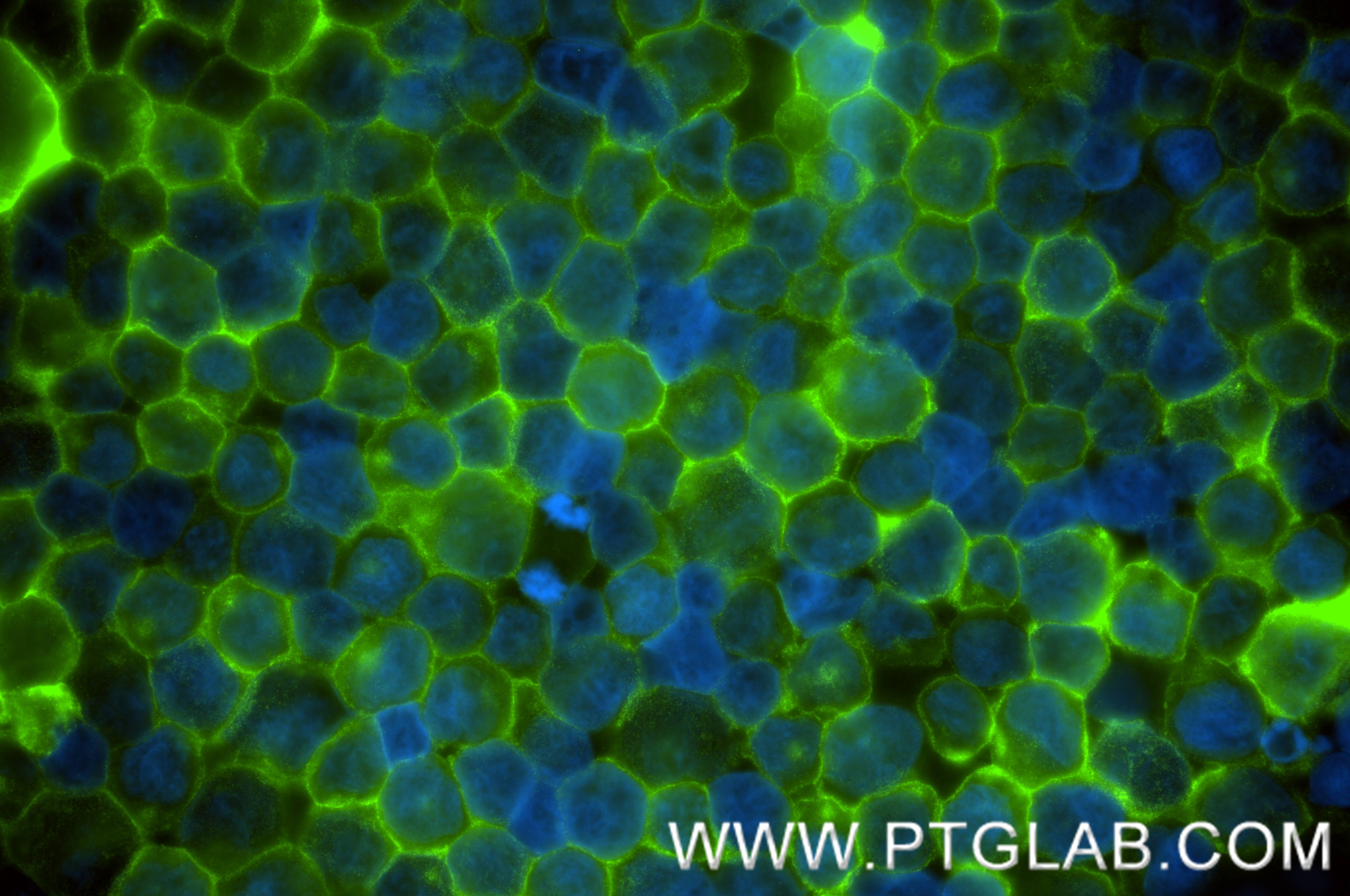 IF Staining of Raji using 83523-4-RR (same clone as 83523-4-PBS)