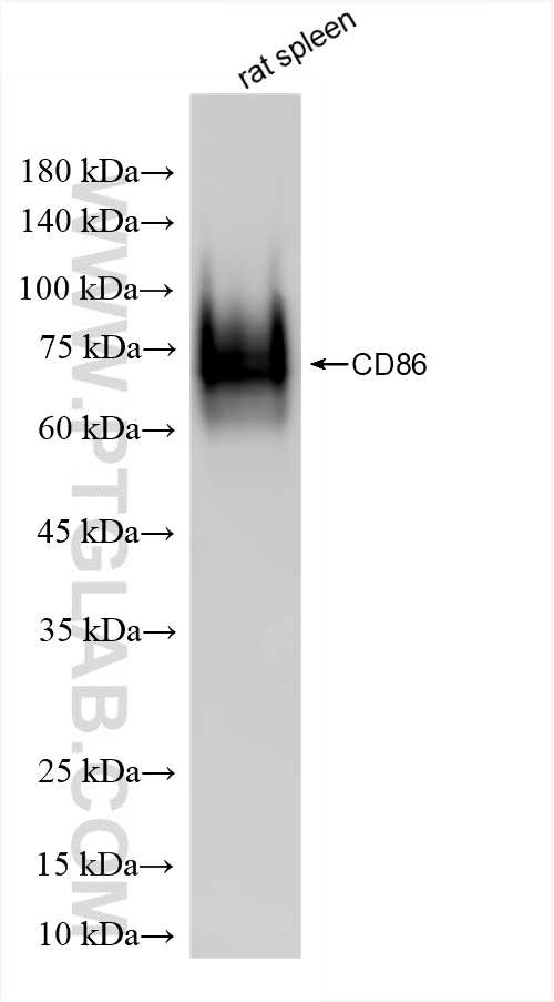 WB analysis of rat spleen using 86252-1-RR (same clone as 86252-1-PBS)