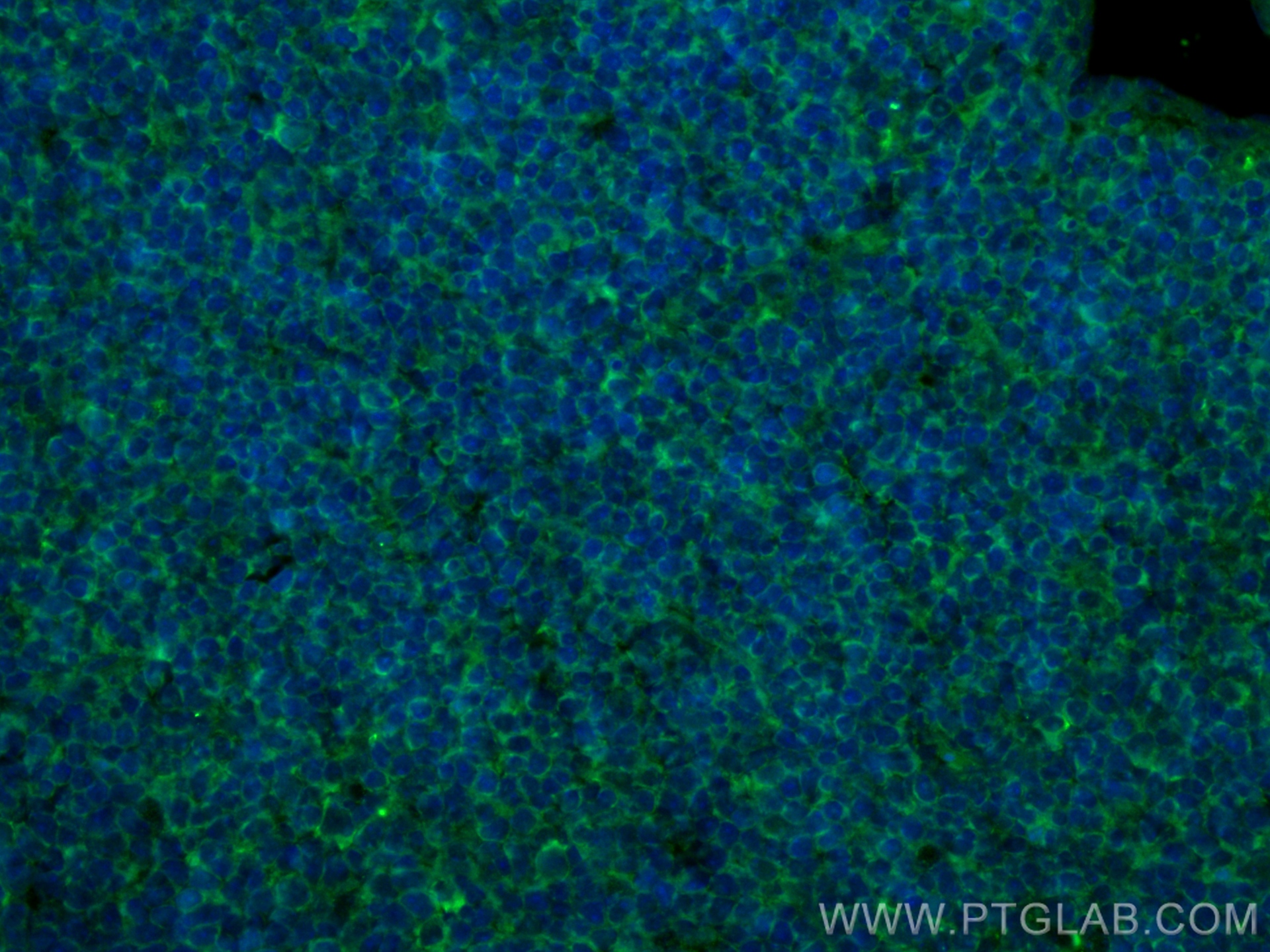 IF Staining of mouse spleen using FITC-65068