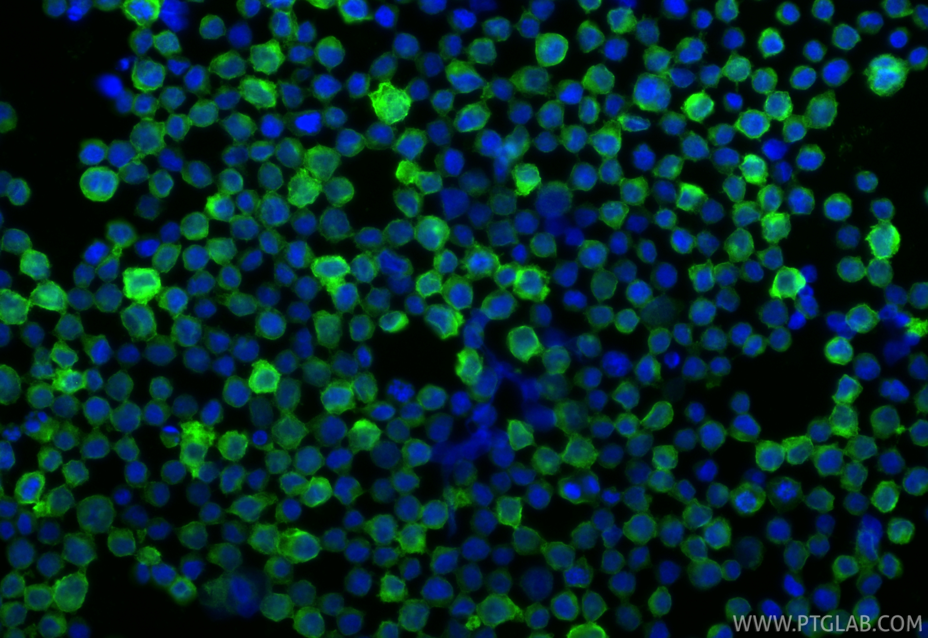 IF Staining of Raji using RMX00027