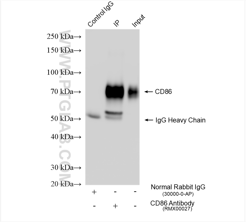 IP experiment of Raji using RMX00027