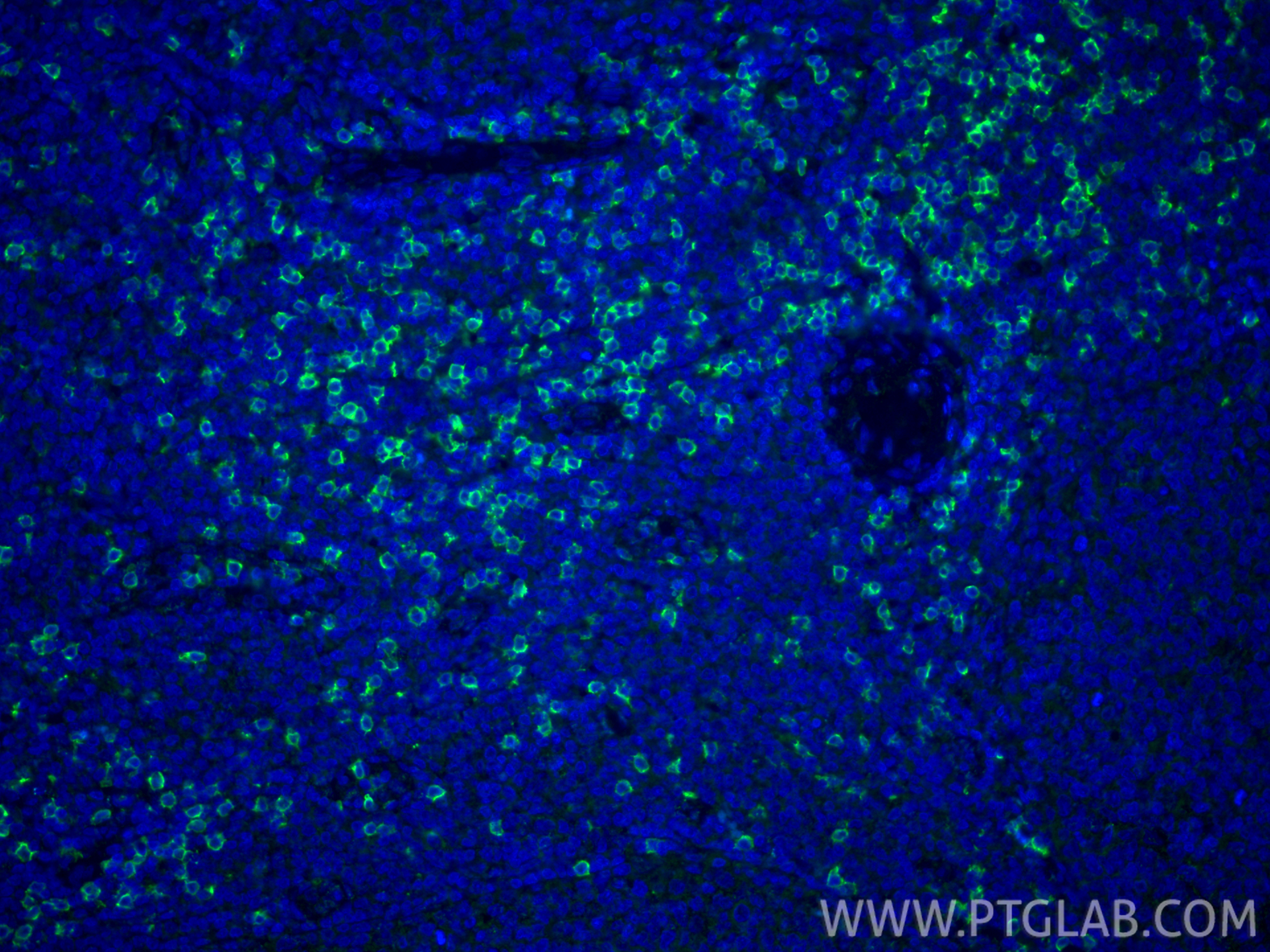 IF Staining of human tonsillitis using 66868-1-Ig (same clone as 66868-1-PBS)