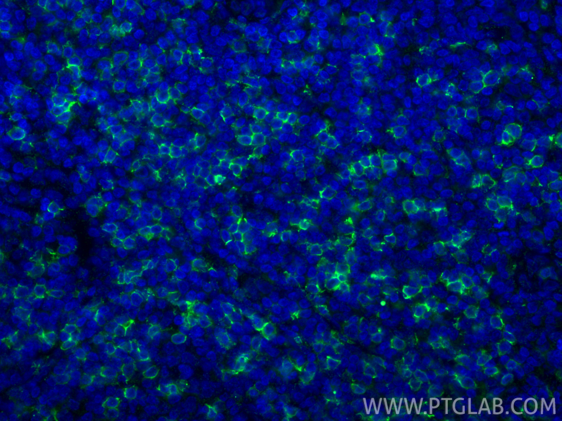 IF Staining of human tonsillitis using 66868-1-Ig (same clone as 66868-1-PBS)