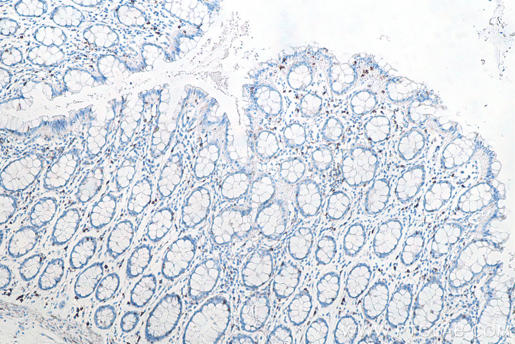 IHC staining of human colon using 66868-1-Ig IHC staining of human colon using 66868-1-Ig