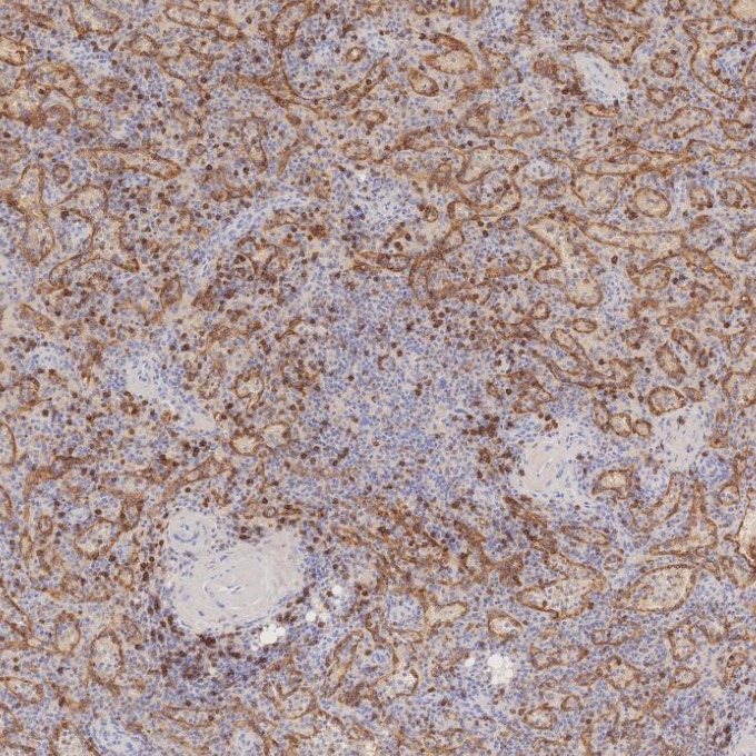 IHC staining of human spleen using 66868-1-Ig