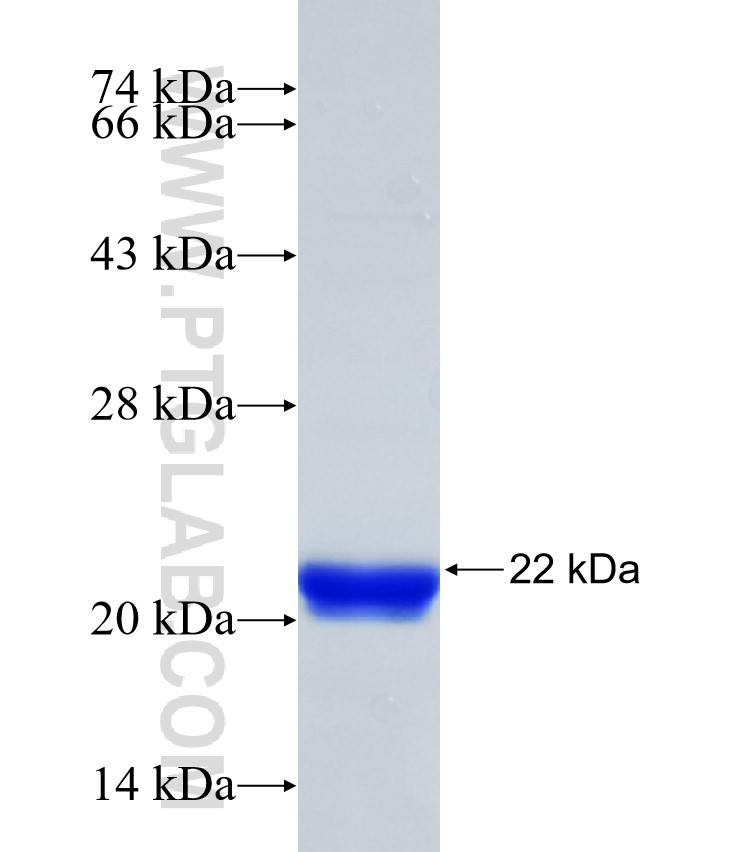 CD8A fusion protein Ag31942 SDS-PAGE