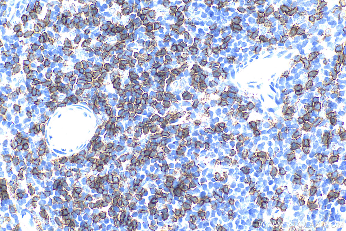 IHC staining of rat spleen using 33186-1-AP