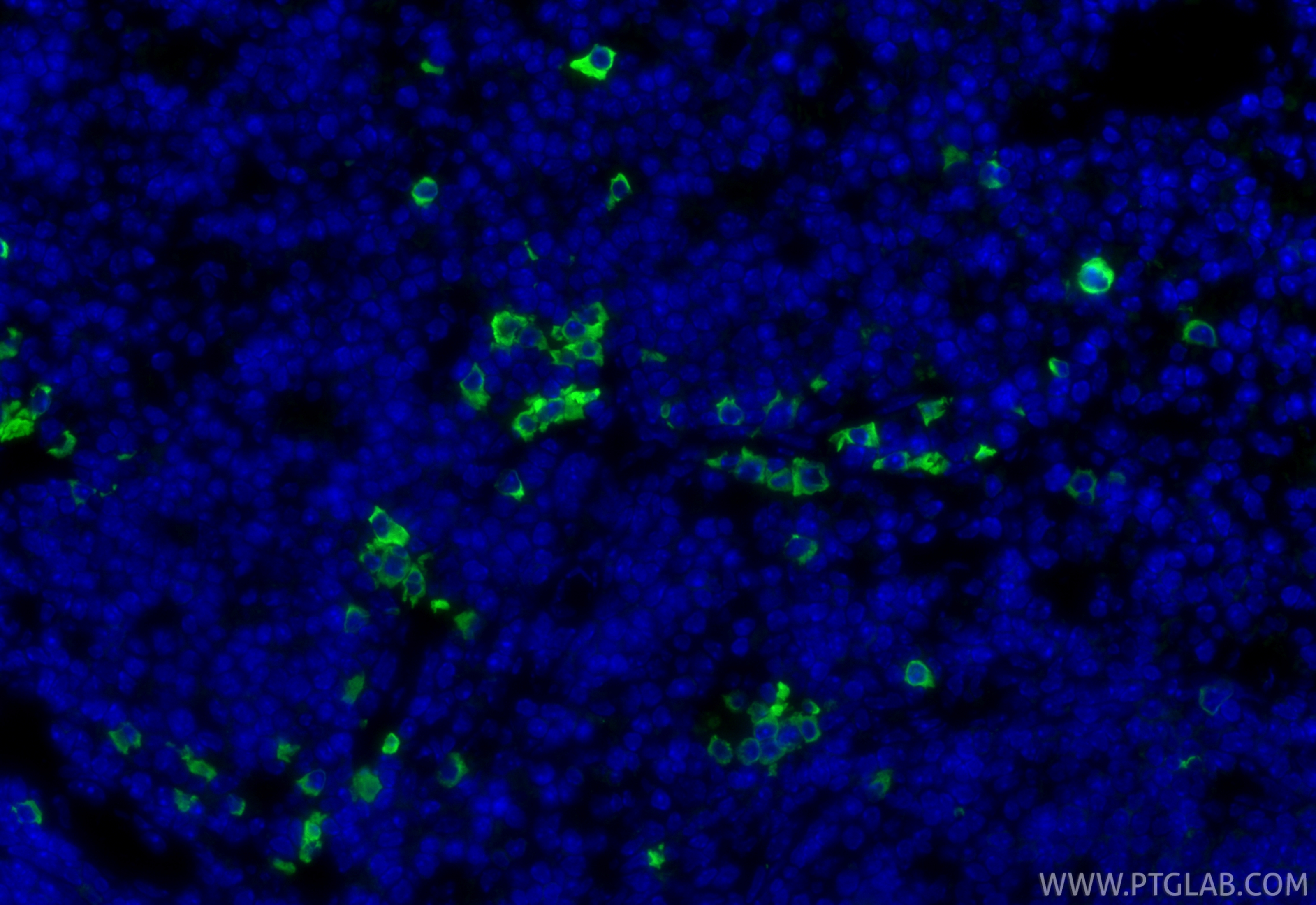 IF Staining of mouse spleen using 65069-1-Ig
