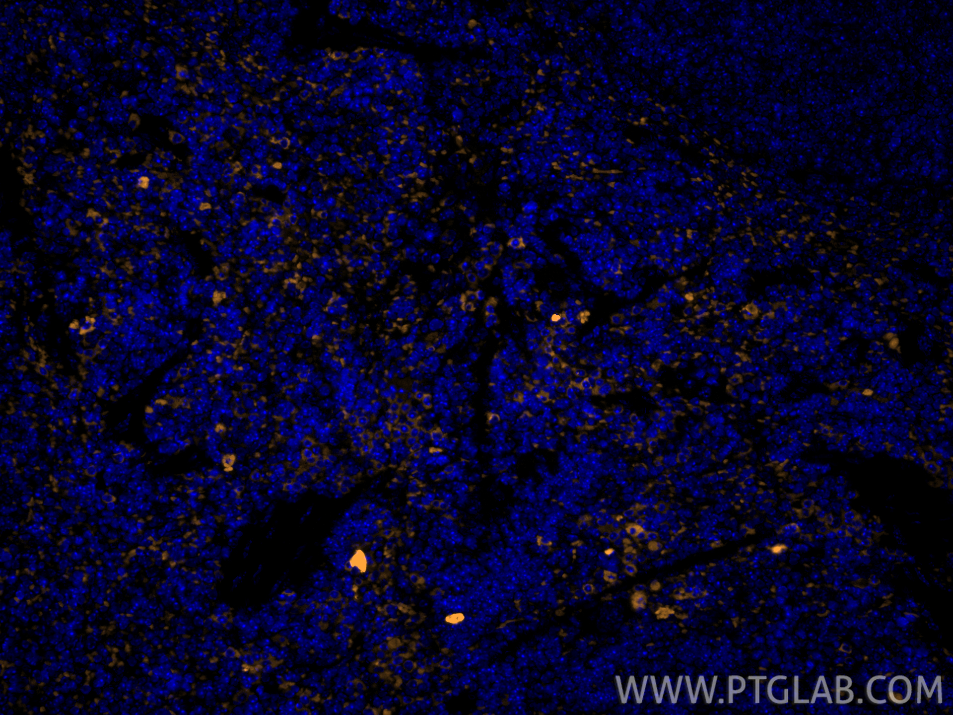 IF Staining of mouse spleen using 65205-1-Ig IF Staining of mouse spleen using 65205-1-Ig