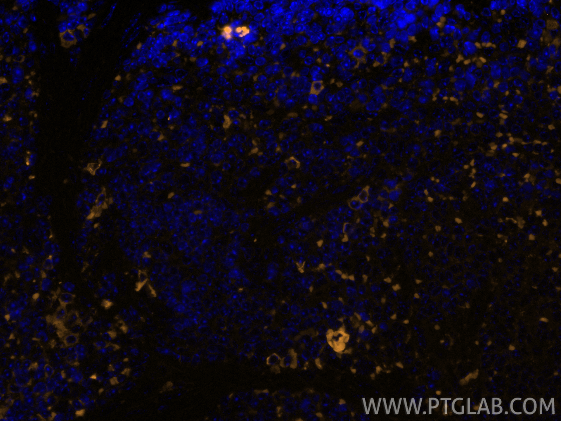 IF Staining of mouse spleen using 65205-1-Ig IF Staining of mouse spleen using 65205-1-Ig