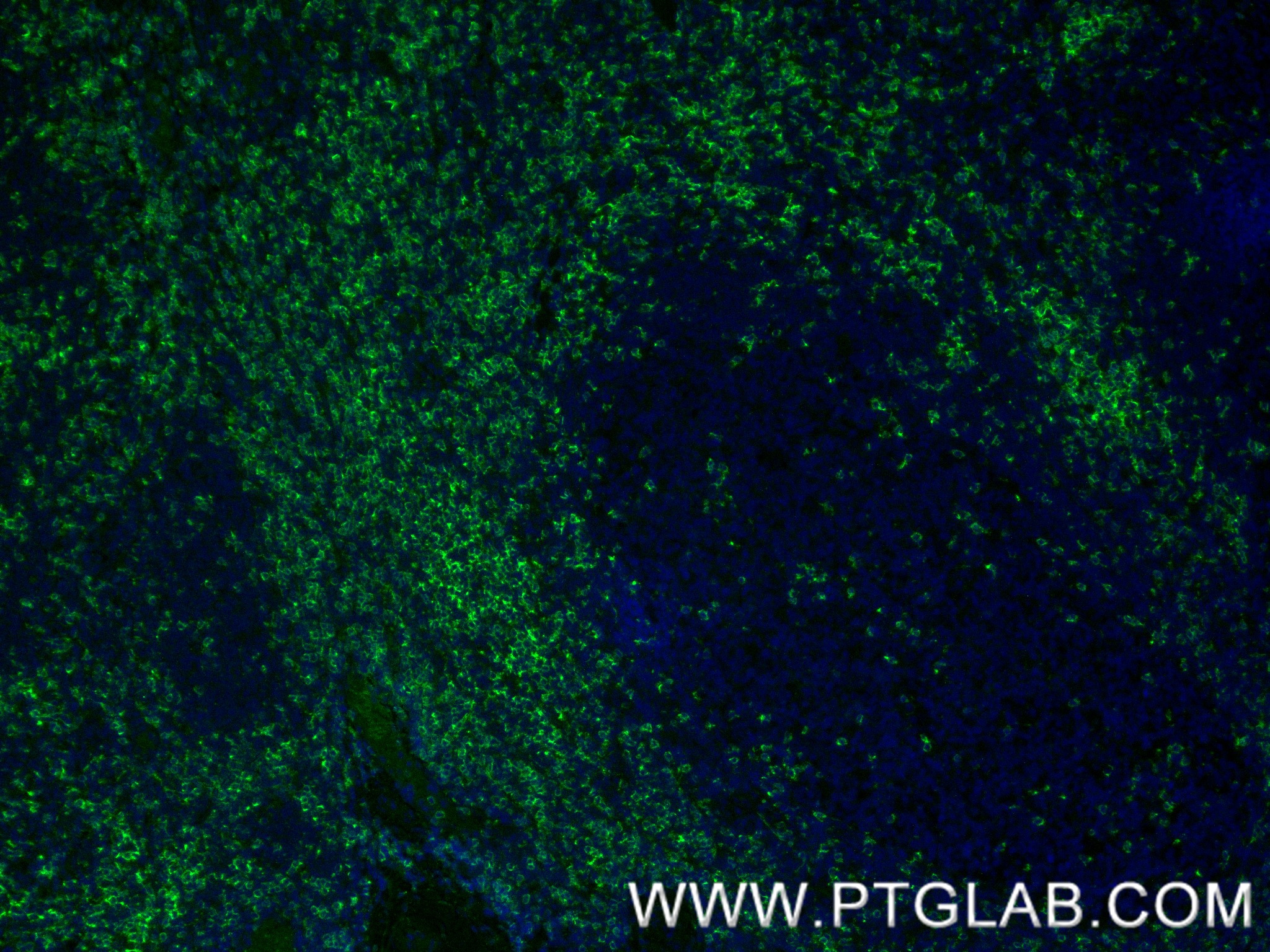IF Staining of human tonsillitis using 86063-2-RR