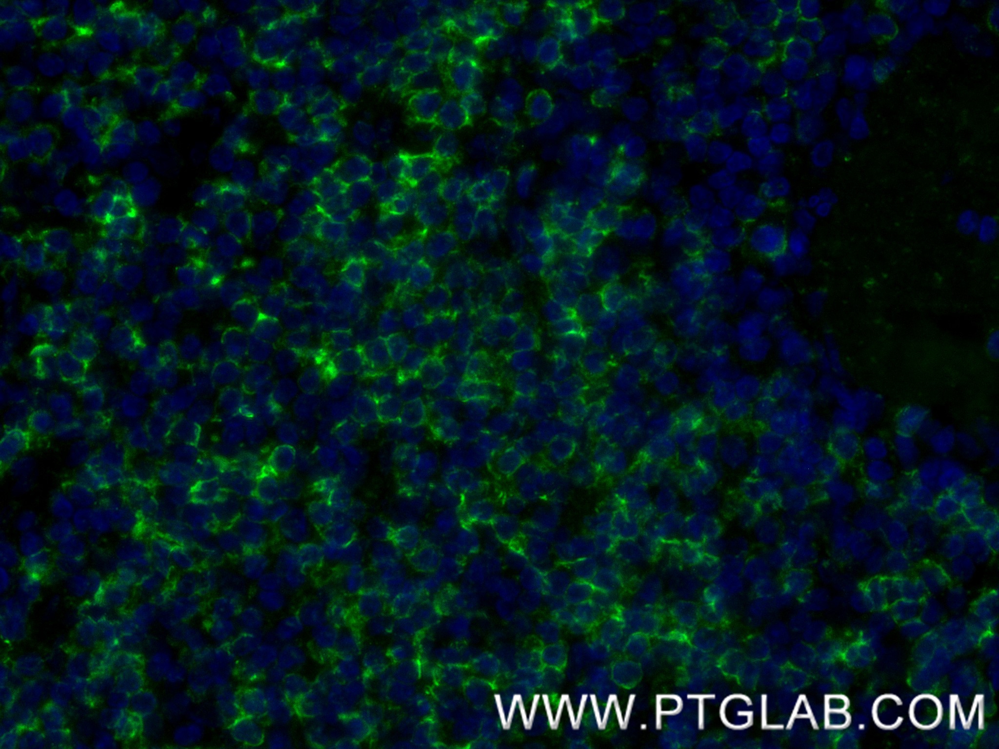 IF Staining of human tonsillitis using 86063-2-RR