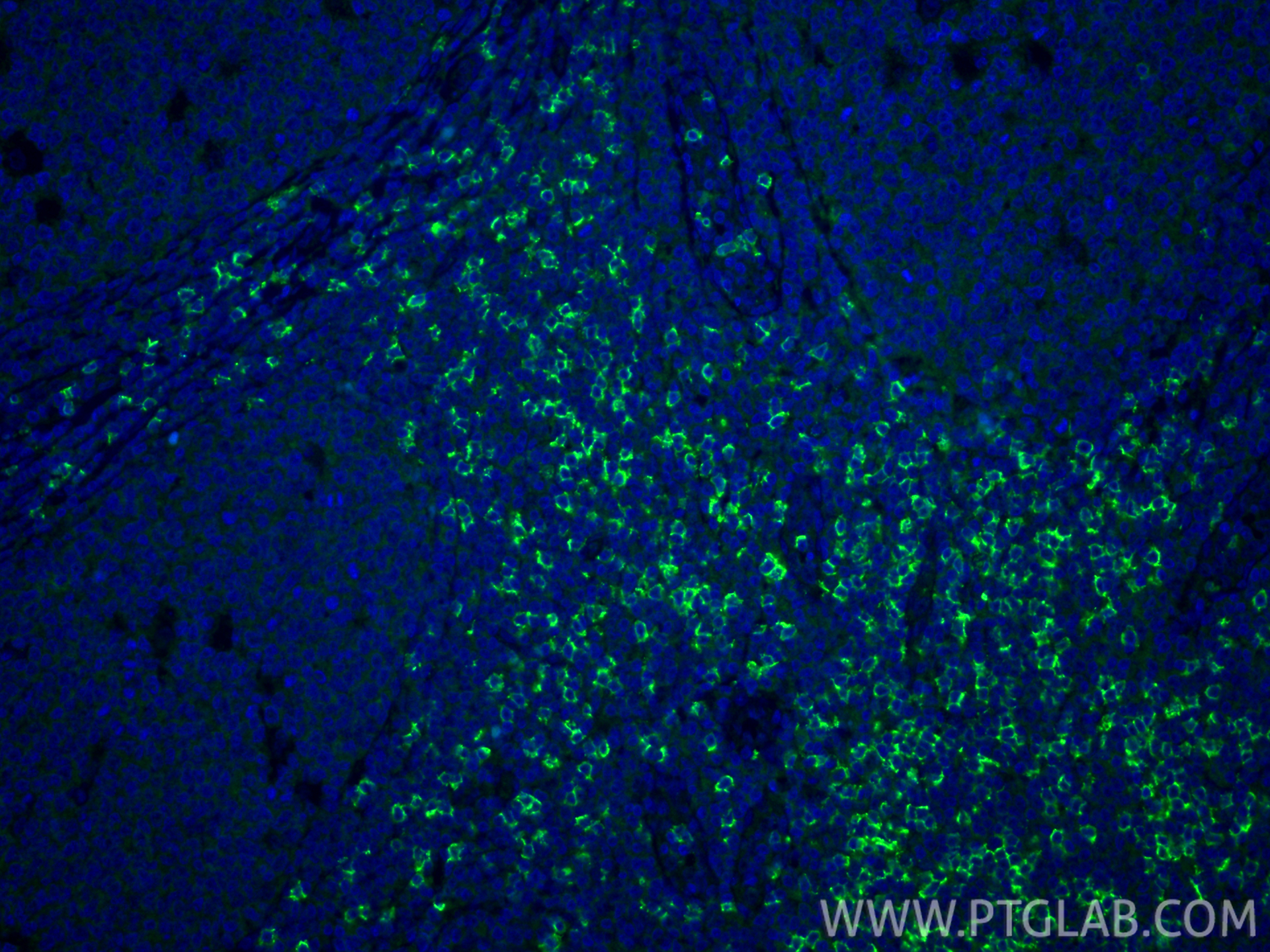 IF Staining of human tonsillitis using 86063-2-RR