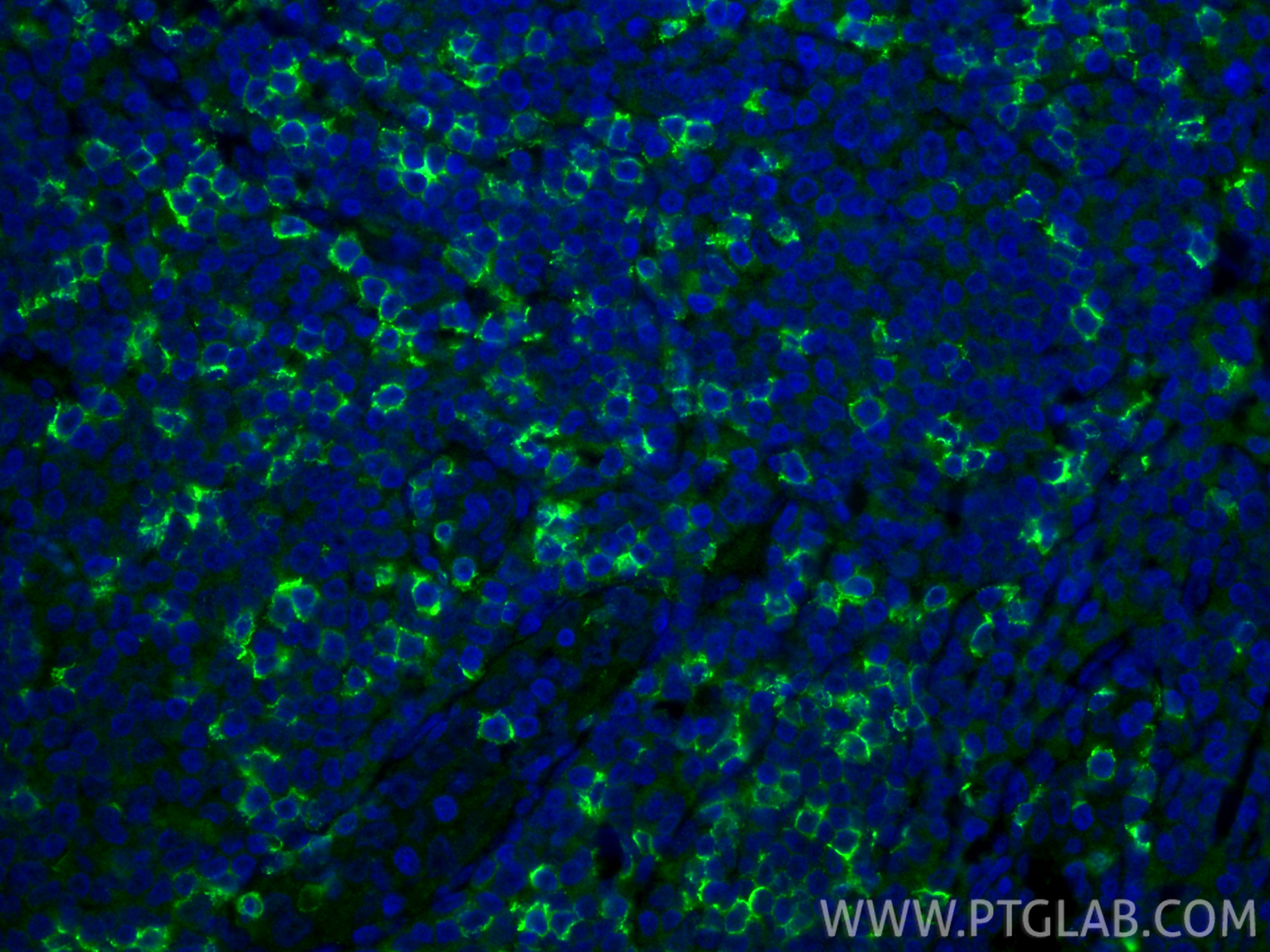 IF Staining of human tonsillitis using 86063-2-RR