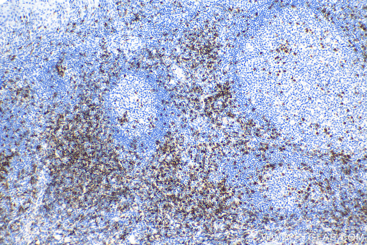 IHC staining of human tonsillitis using 86063-2-RR