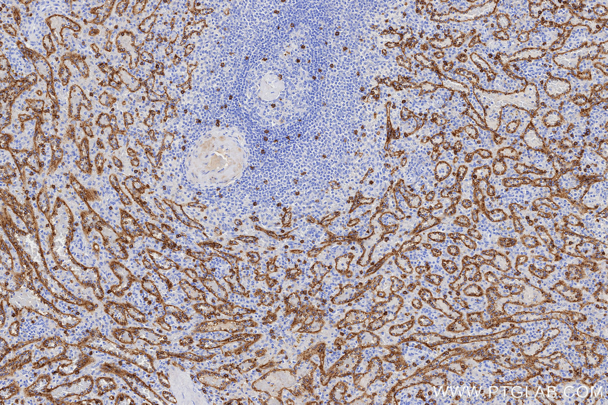 IHC staining of human spleen using 86063-2-RR