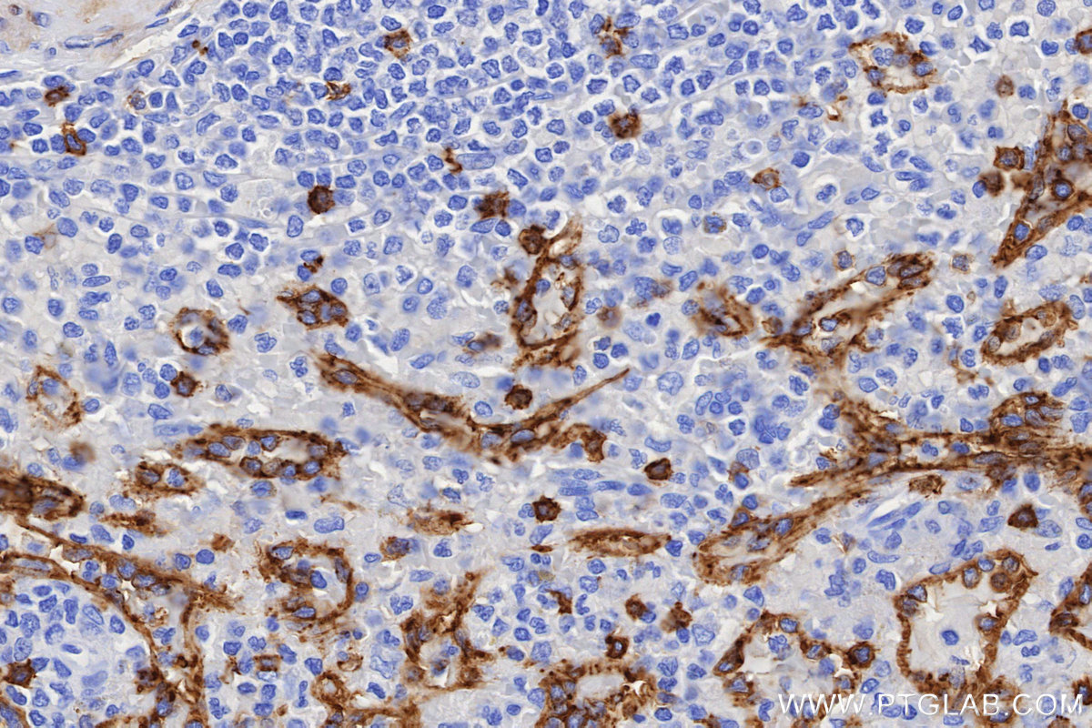 IHC staining of human spleen using 86063-2-RR