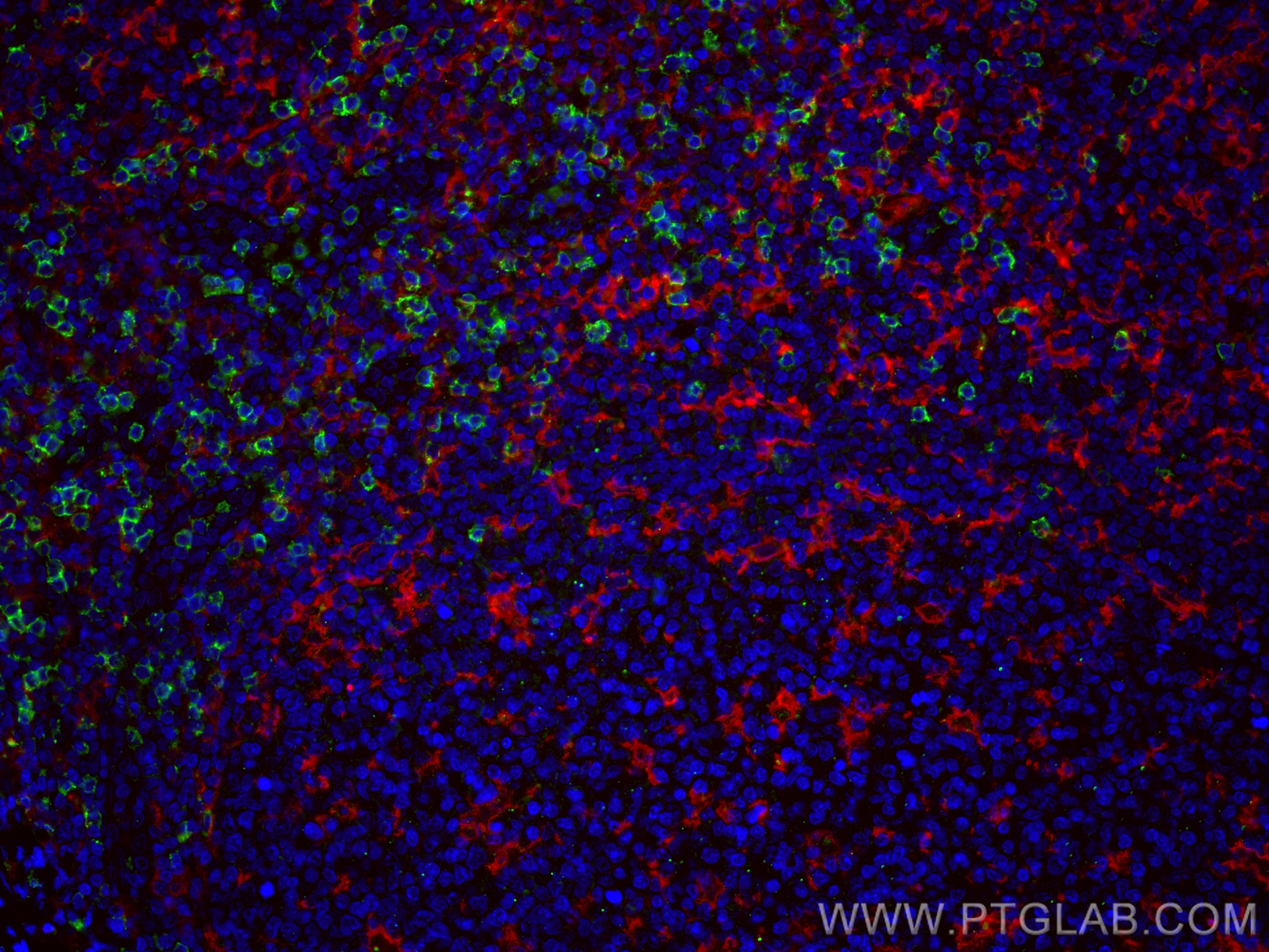 IF Staining of human tonsillitis using CL488-66868