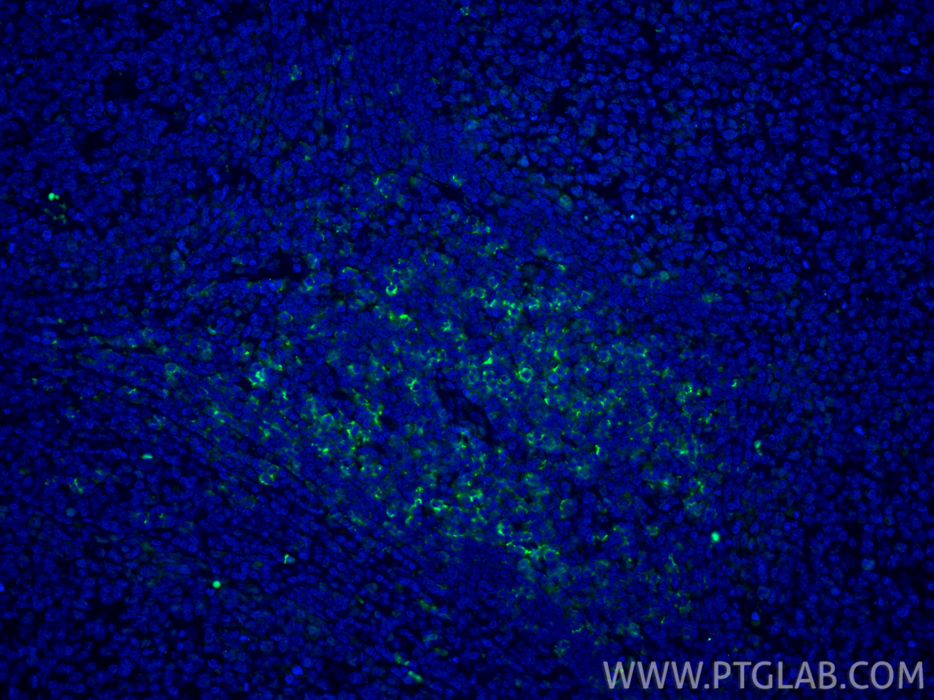 IF Staining of human tonsillitis using CL488-86063-2 IF Staining of human tonsillitis using CL488-86063-2