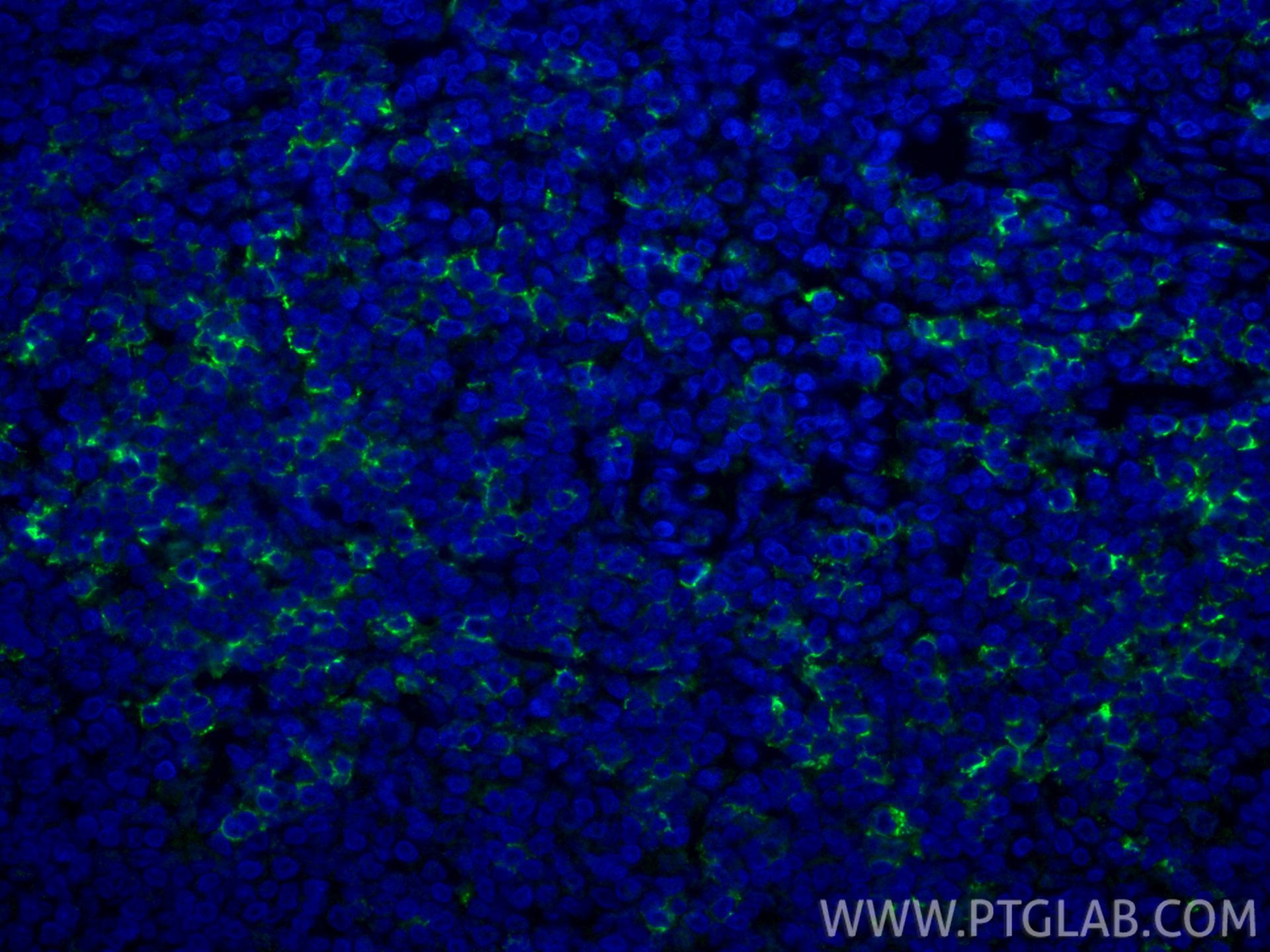 IF Staining of human tonsillitis using CL488-86063-2 IF Staining of human tonsillitis using CL488-86063-2