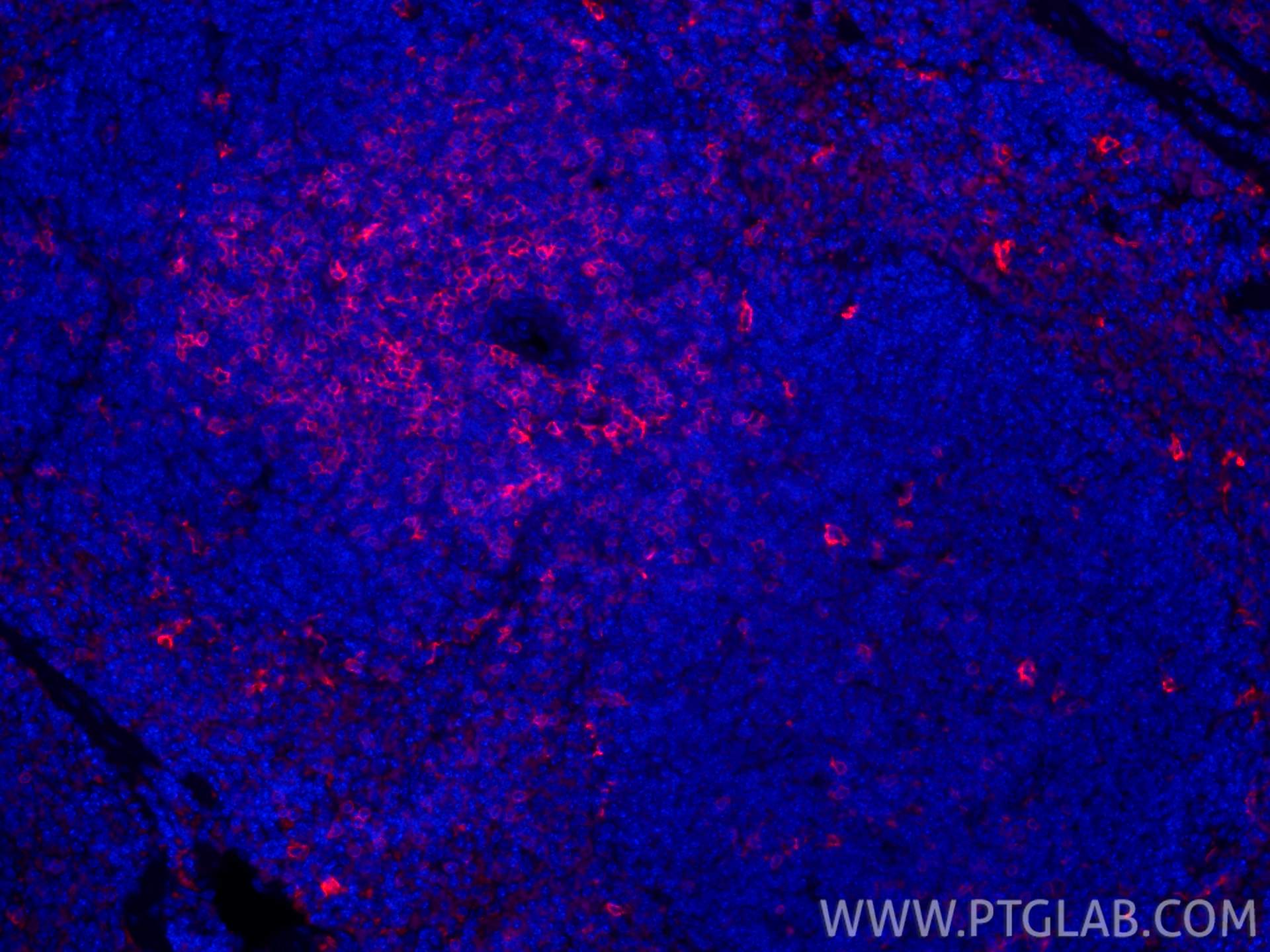 IF Staining of mouse spleen using CL594-85977-4