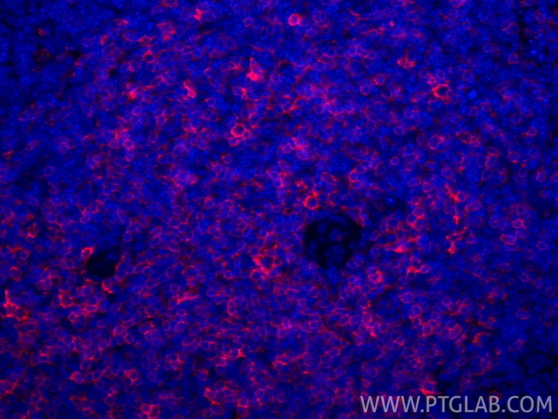 IF Staining of mouse spleen using CL594-85977-4