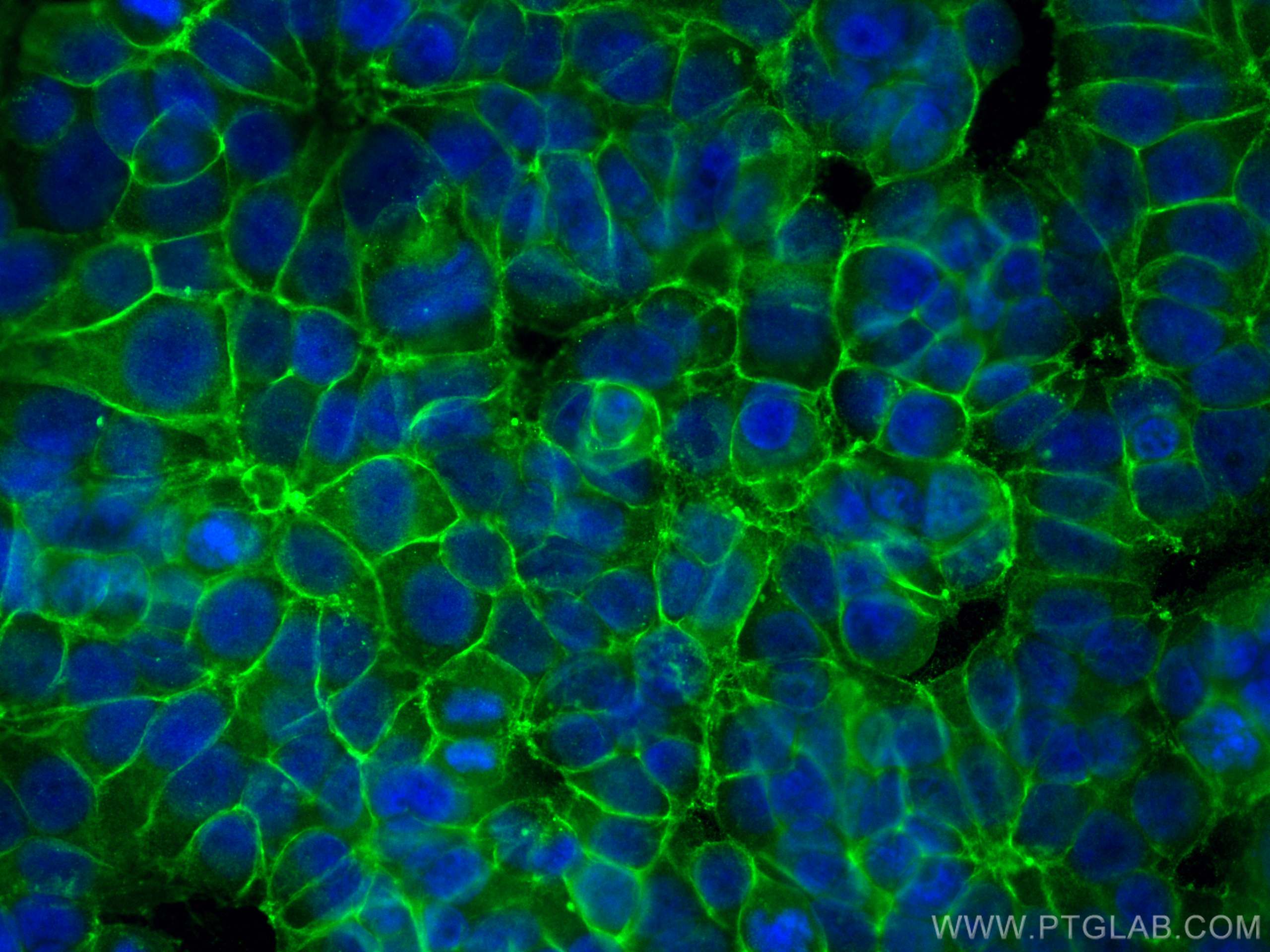 IF Staining of MCF-7 using 20597-1-AP