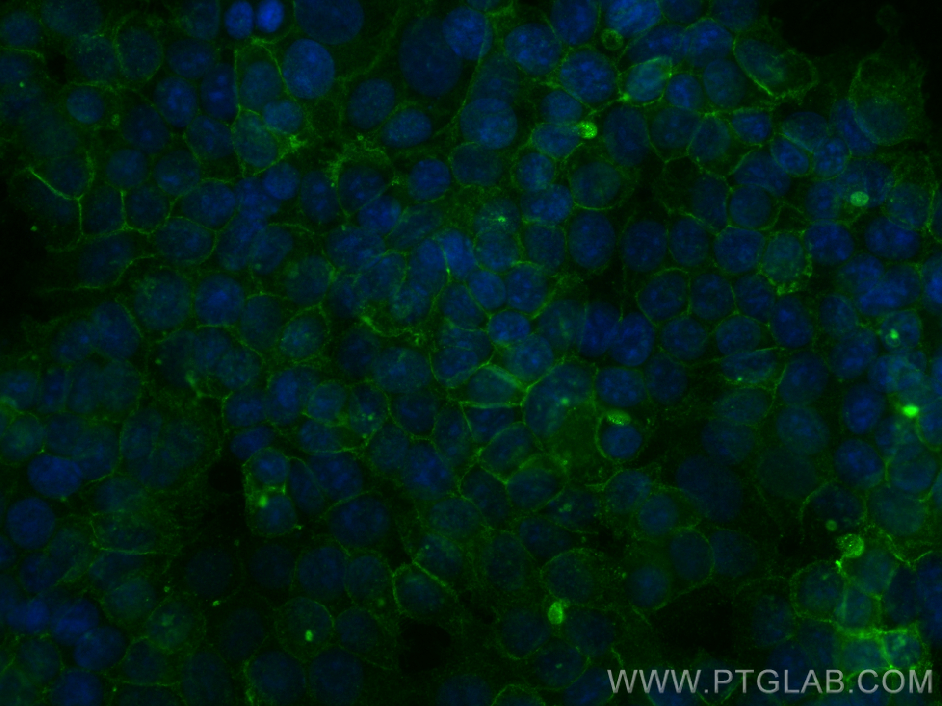 IF Staining of MCF-7 using 84142-1-RR (same clone as 84142-1-PBS)