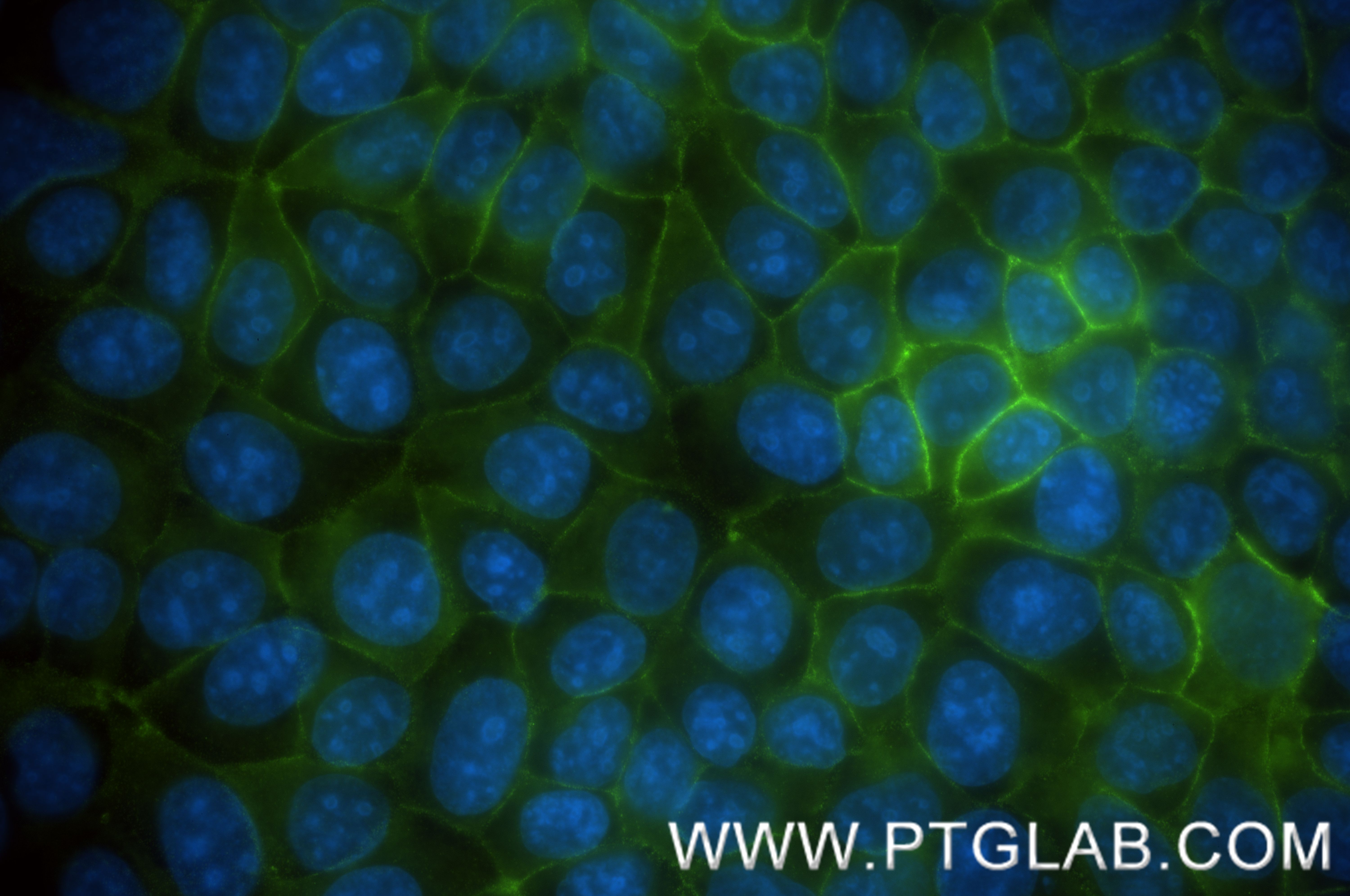 Immunofluorescent analysis of (-20°C Methanol) fixed MCF-7 cells using CD9 antibody (<a class='green' href='/productredirect?CatalogNo=84142-1-RR' target='_blank'>84142-1-RR</a>, Clone: 240830A8 ) at dilution of 1:400 and CoraLite®488-Conjugated Goat Anti-Rabbit IgG(H+L) (<a class='green' href='/productredirect?CatalogNo=SA00013-2' target='_blank'>SA00013-2</a>). This data was developed using the same antibody clone with 84142-1-PBS in a different storage buffer formulation. IF Staining of MCF-7 using 84142-1-RR (same clone as 84142-1-PBS)