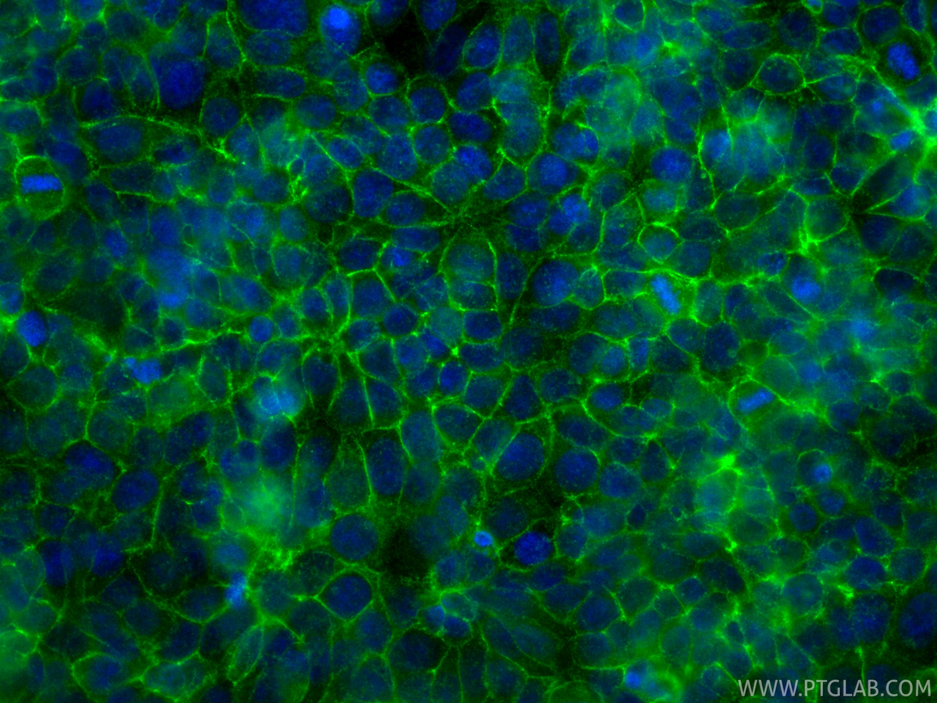 IF Staining of MCF-7 using 84142-1-RR IF Staining of MCF-7 using 84142-1-RR