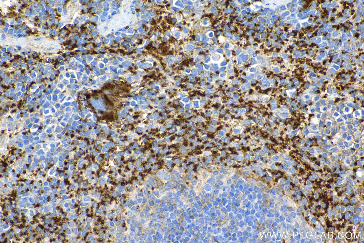 IHC staining of mouse spleen using 84801-13-RR