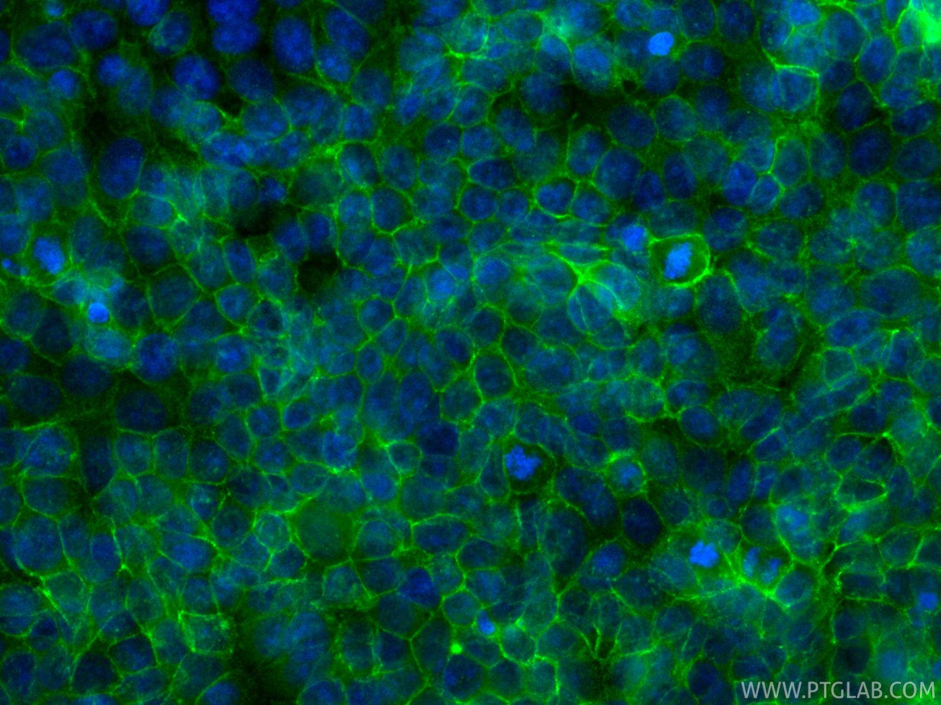 IF Staining of MCF-7 using CL488-84142 IF Staining of MCF-7 using CL488-84142
