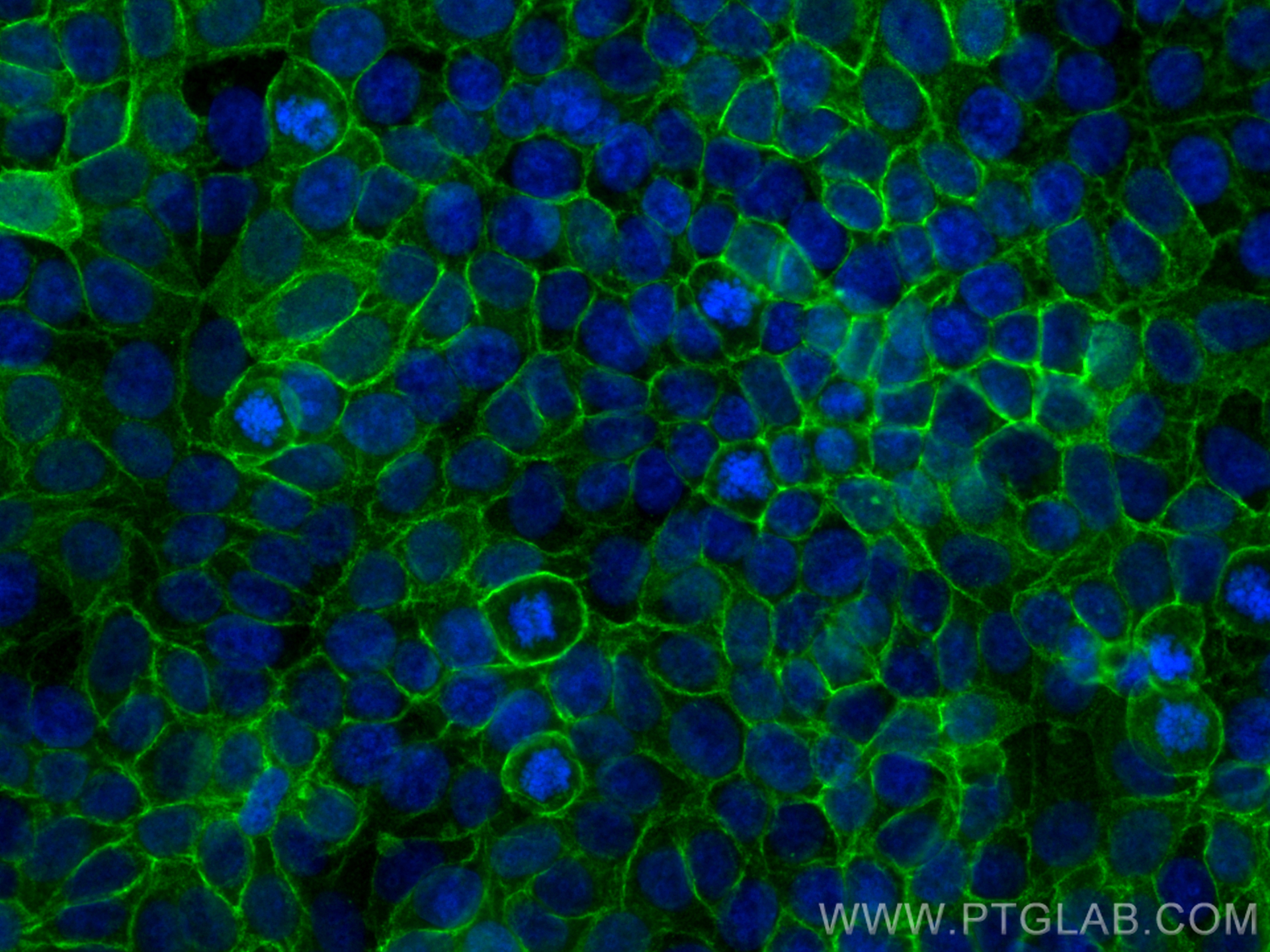IF Staining of MCF-7 using RMX00018