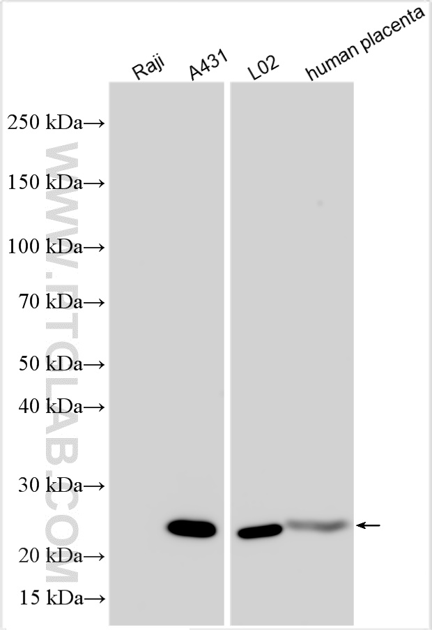 WB analysis using RMX00018